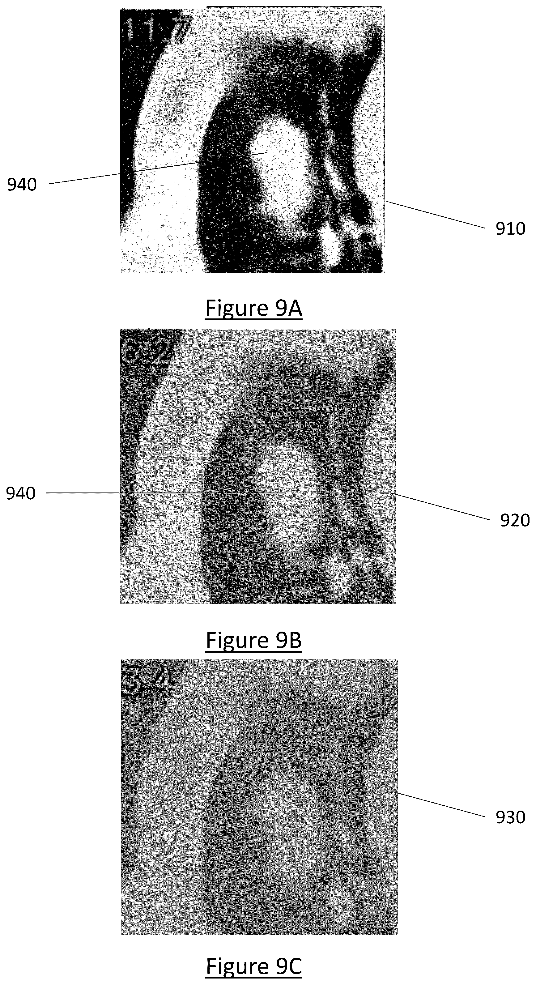 Patent US12602854 Figure 17 – System and method for medical imaging