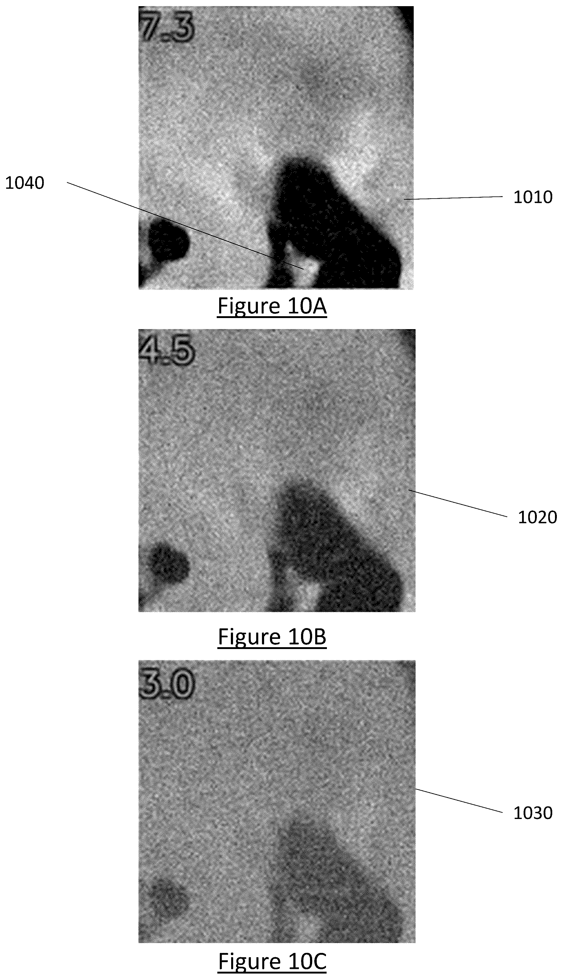 Patent US12602854 Figure 18 – System and method for medical imaging