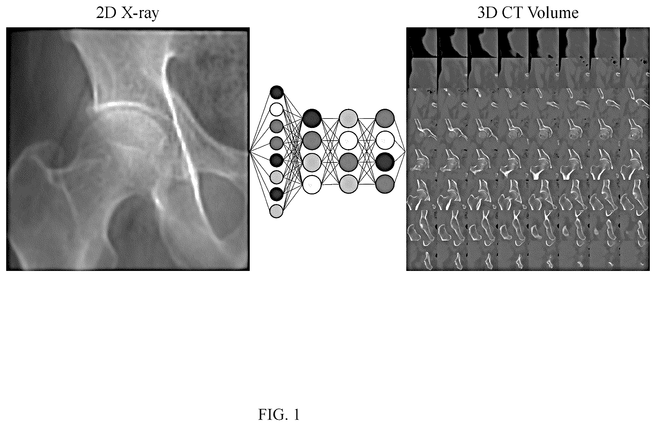 Patent US12602860 Figure 1 – Method for constructing three-dimensional medical image