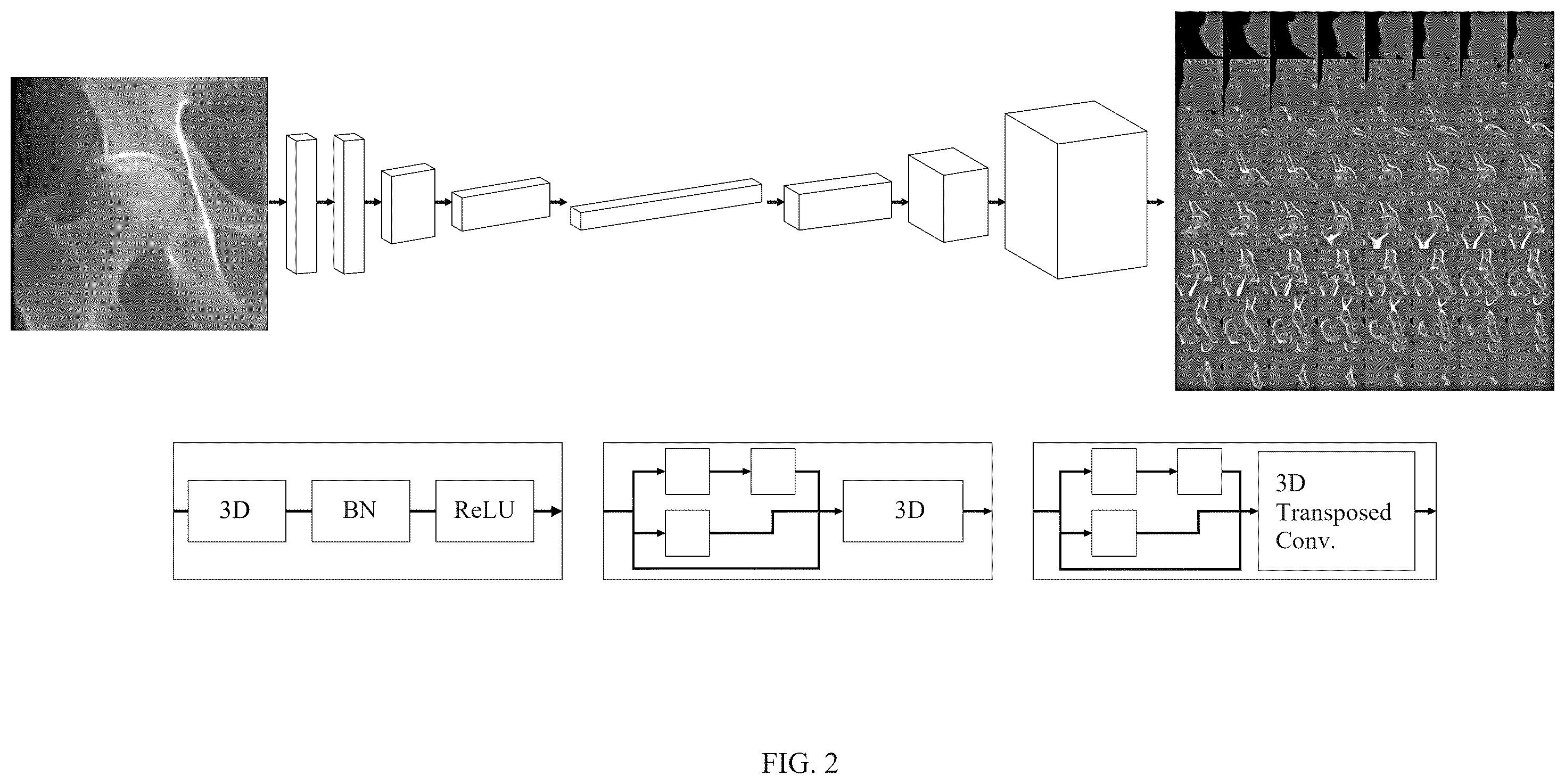 Patent US12602860 Figure 2 – Method for constructing three-dimensional medical image