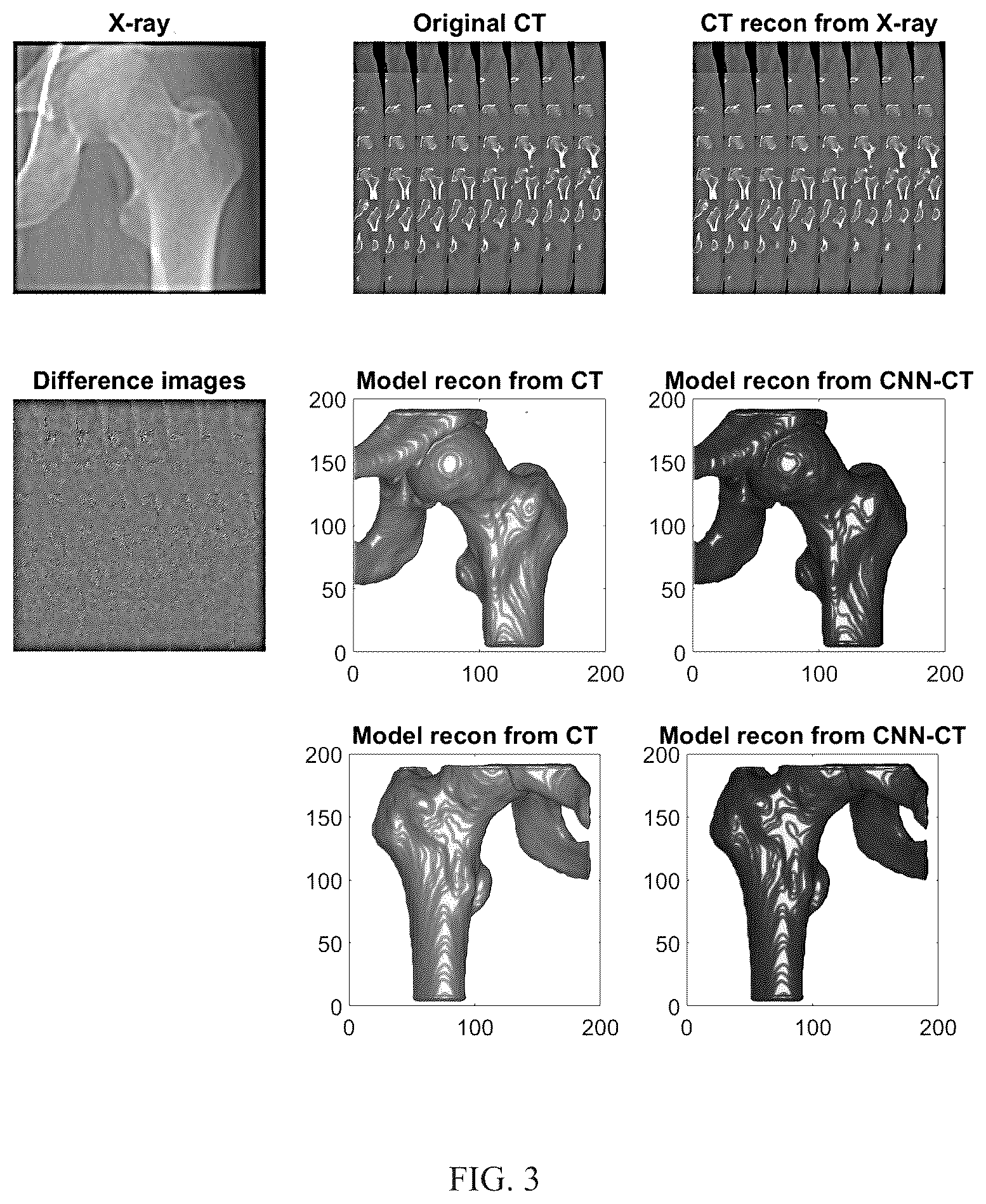 Patent US12602860 Figure 3 – Method for constructing three-dimensional medical image