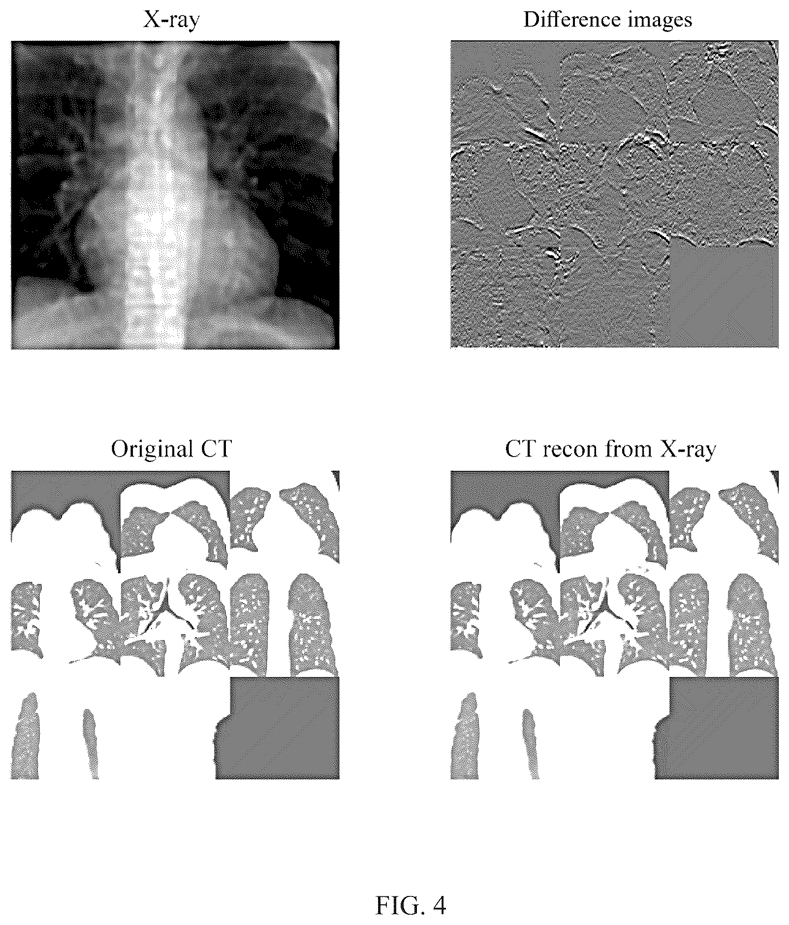 Patent US12602860 Figure 4 – Method for constructing three-dimensional medical image