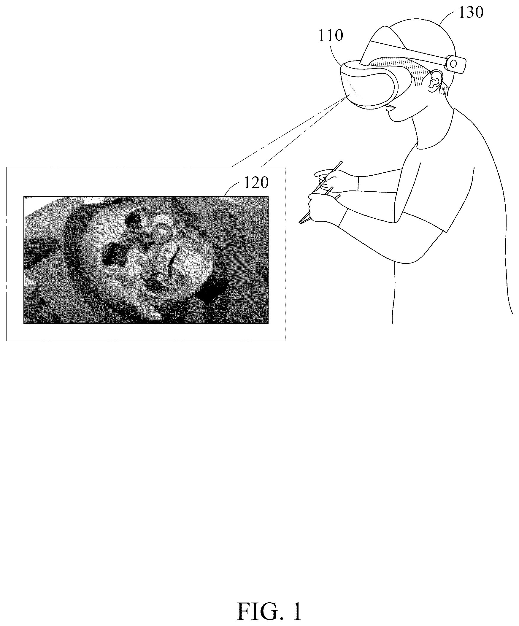 Patent US12602879 — Method and device for providing surgical guide using augmented reality — Figure 1