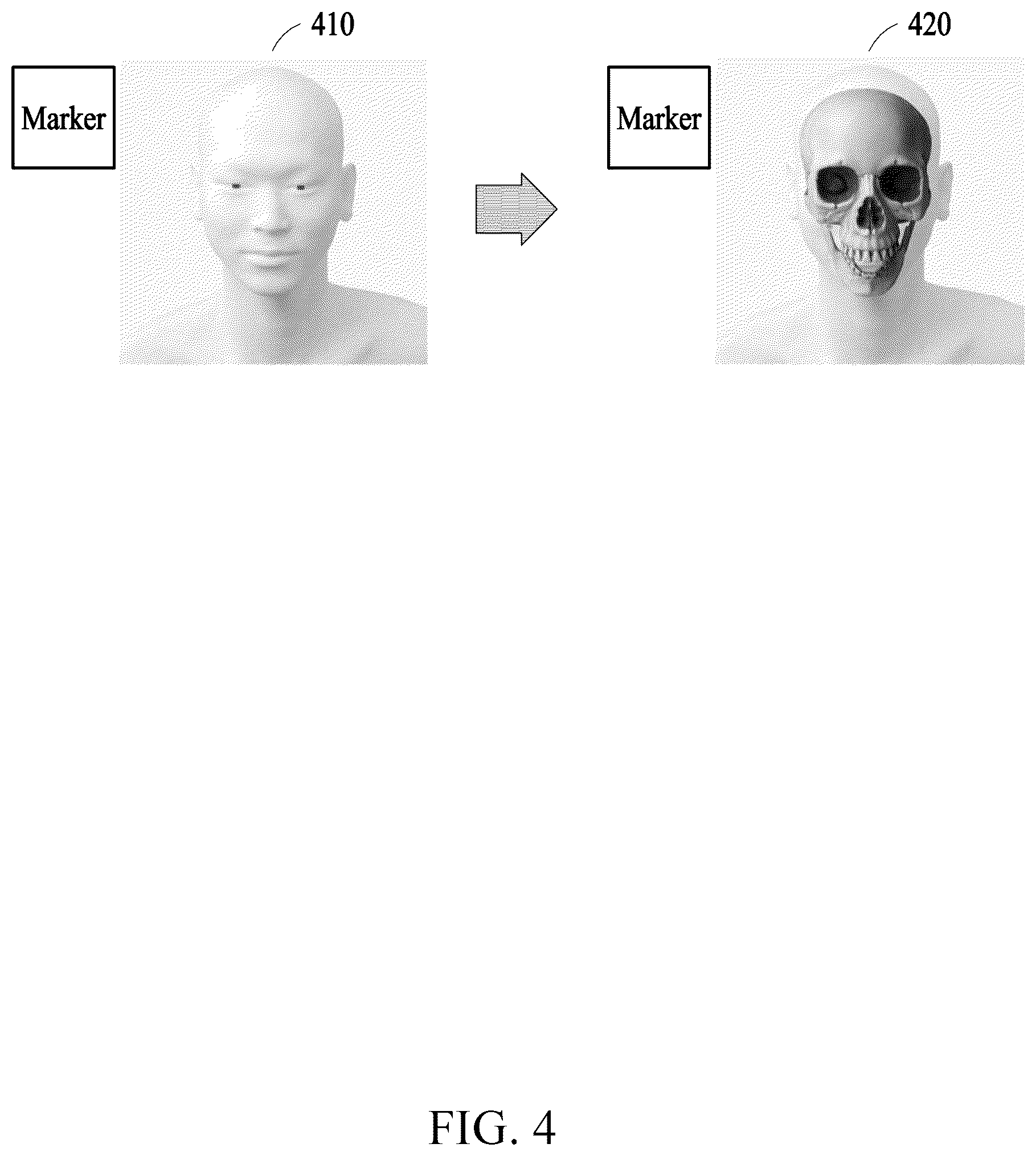Patent US12602879 Figure 4 – Method and device for providing surgical guide using augmented reality