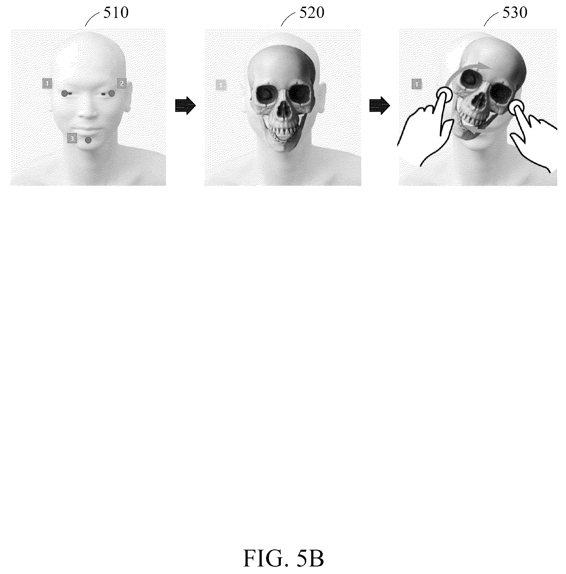 Patent US12602879 Figure 6 – Method and device for providing surgical guide using augmented reality