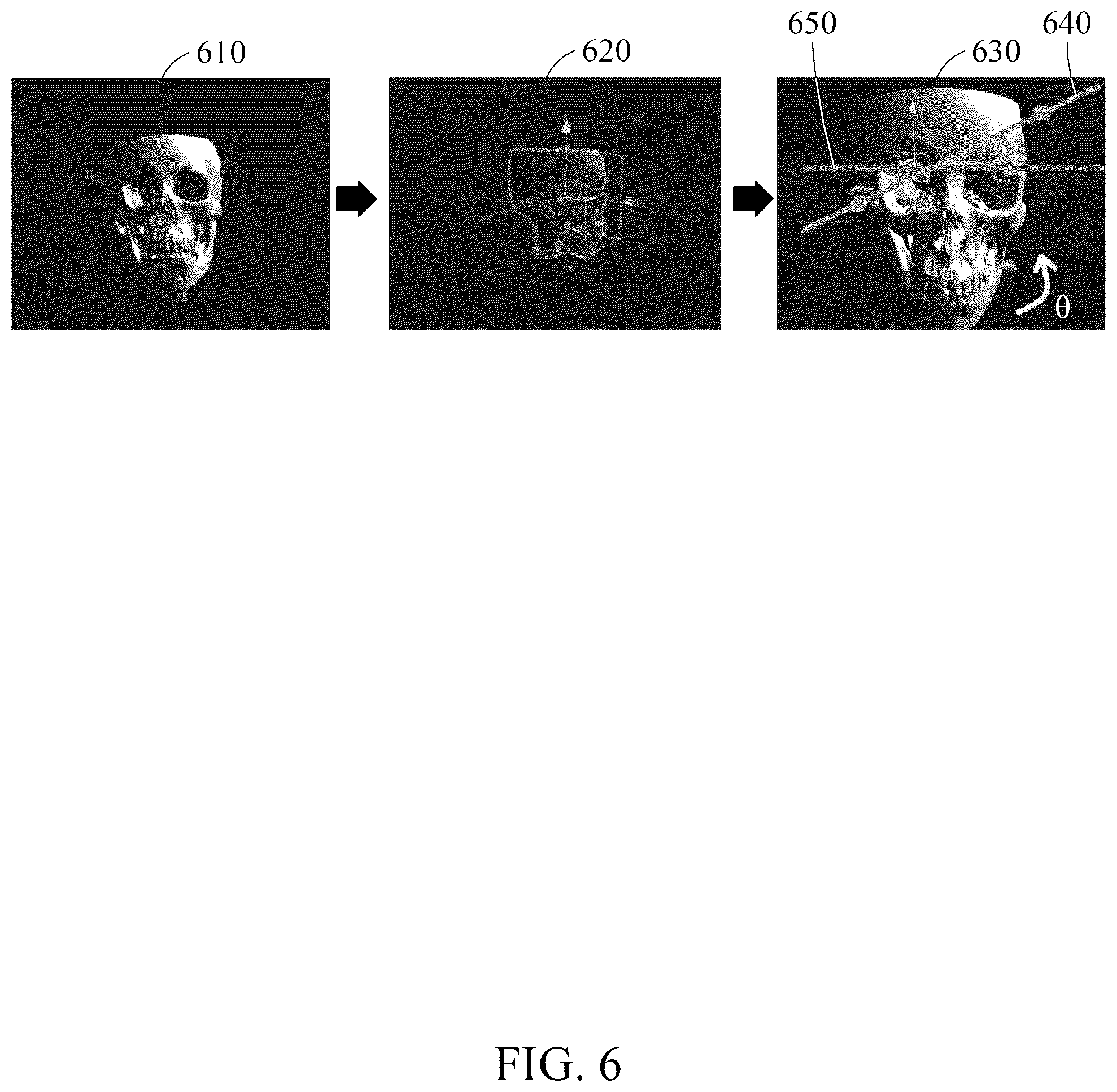 Patent US12602879 Figure 7 – Method and device for providing surgical guide using augmented reality