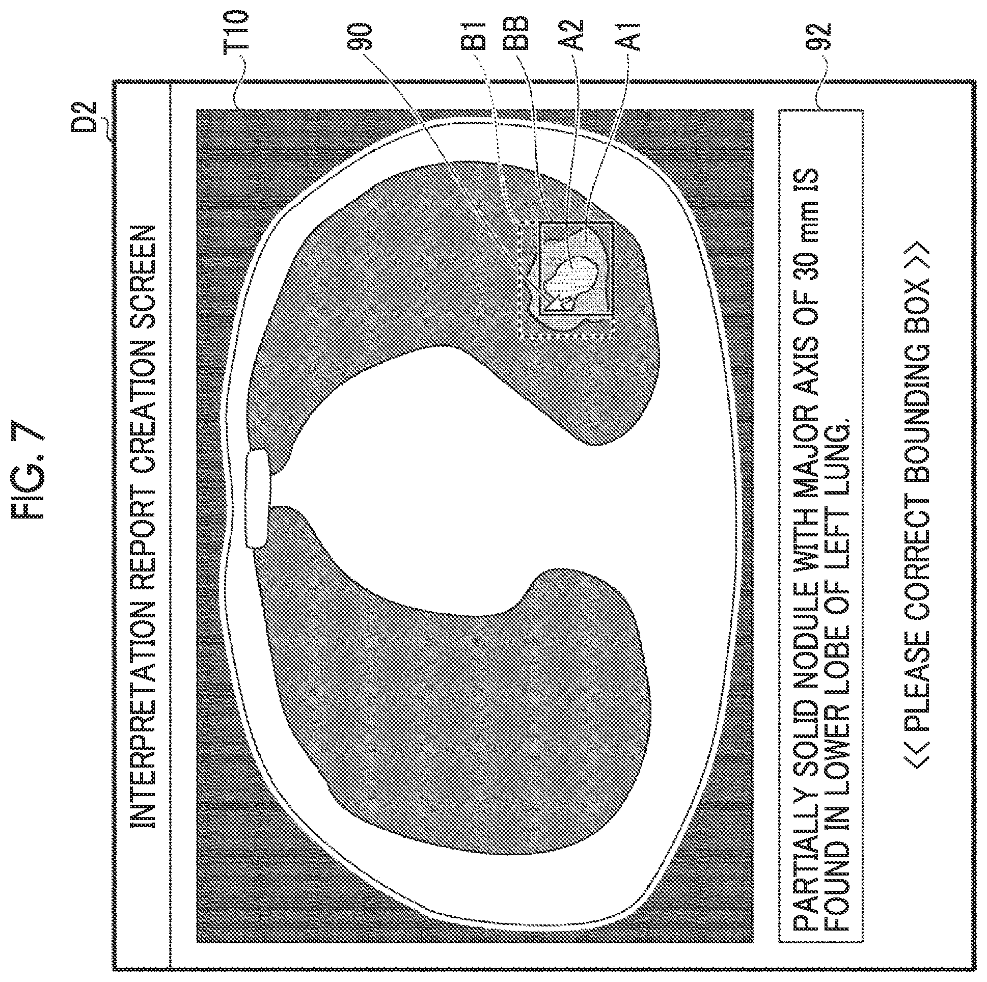 Patent US12602922 Figure 5 – Information processing apparatus, information processing method, and information processing program for supporting interpretation of images