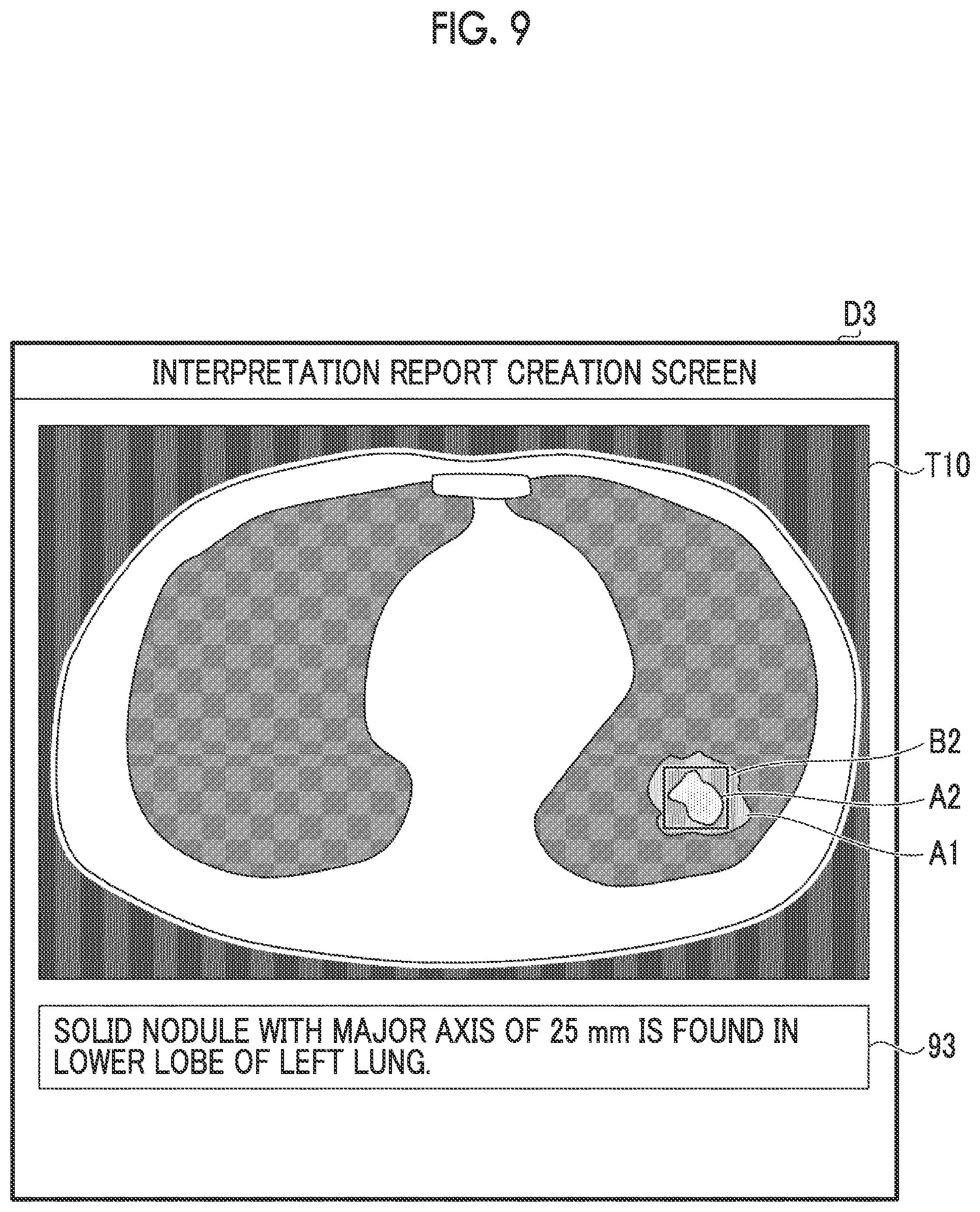 Patent US12602922 Figure 7 – Information processing apparatus, information processing method, and information processing program for supporting interpretation of images