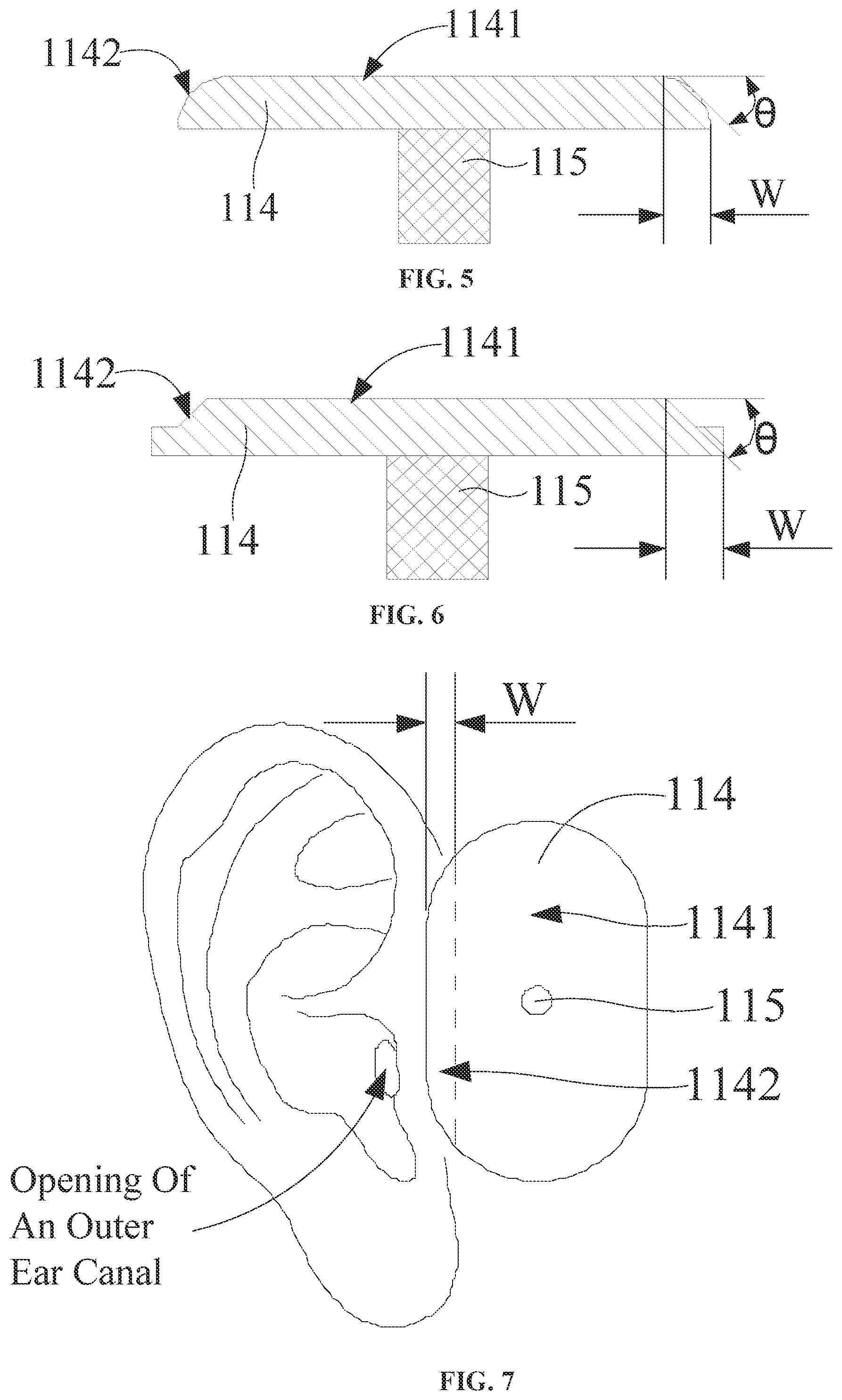 Patent US12610172 Figure 3 – Headphones