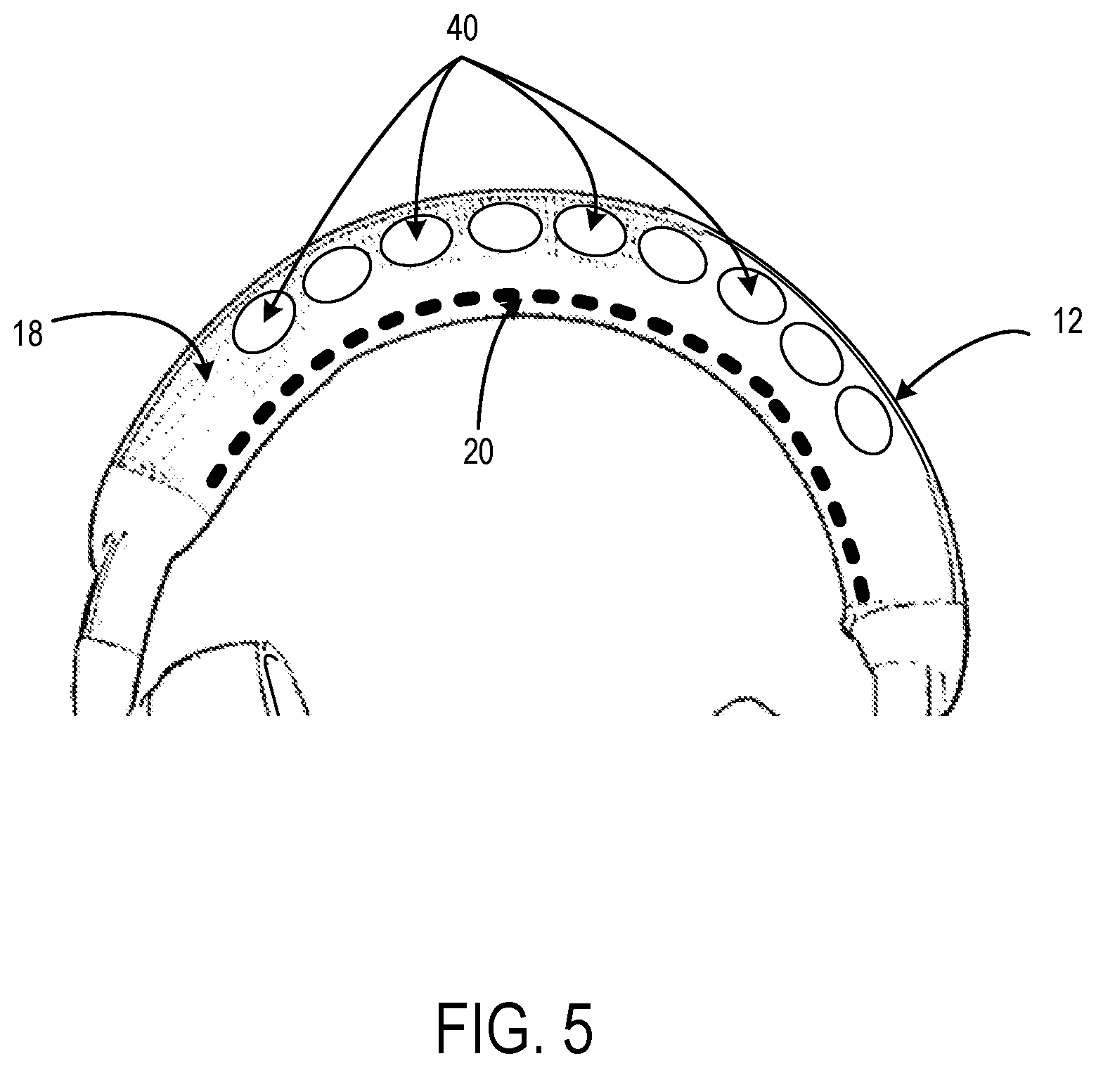 Patent US12610175 Figure 5 – Headset having headband with elastic band and fabric