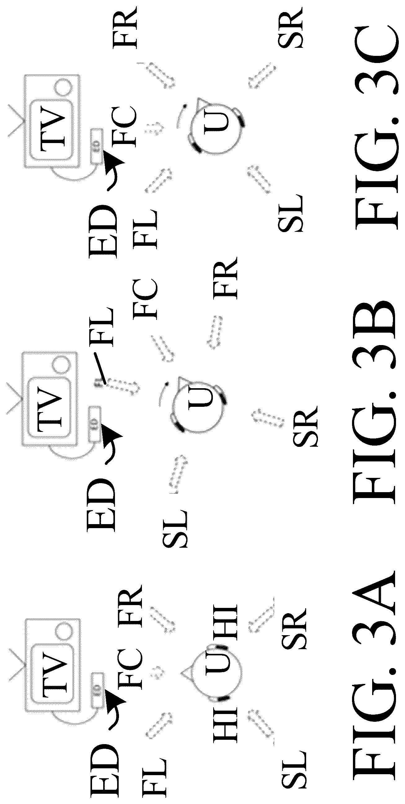 Patent US12610202 Figure 3 – Hearing aid or hearing aid system supporting wireless streaming