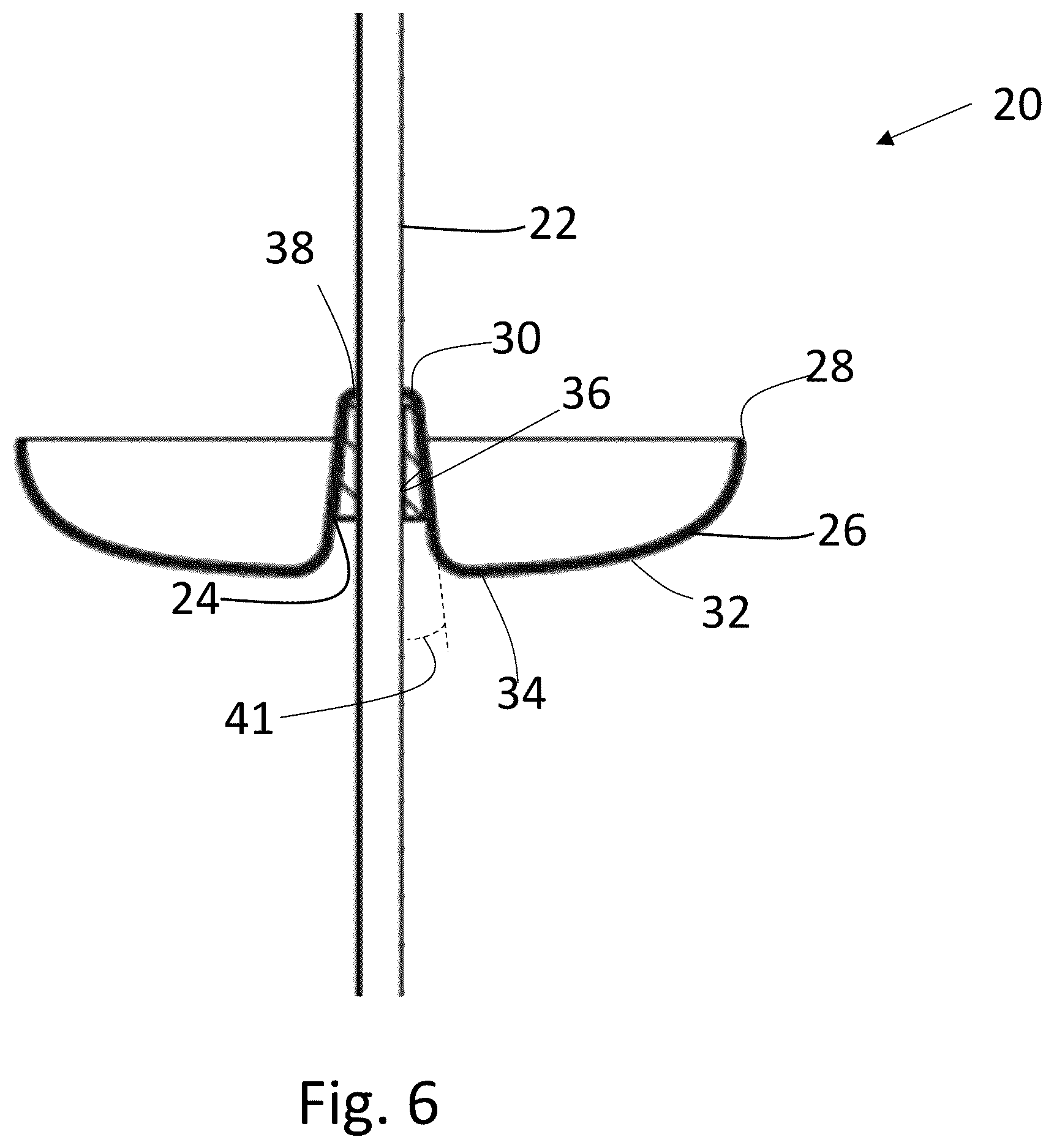 Patent US12610924 Figure 4 – Insect infiltration protection apparatus for pole mounted bird feeder
