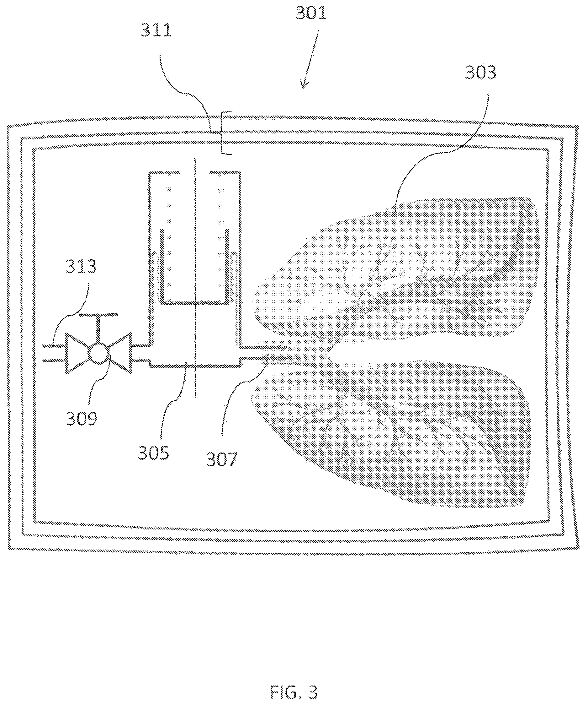 Patent US12610943 Figure 3 – Apparatus for tissue transport and preservation