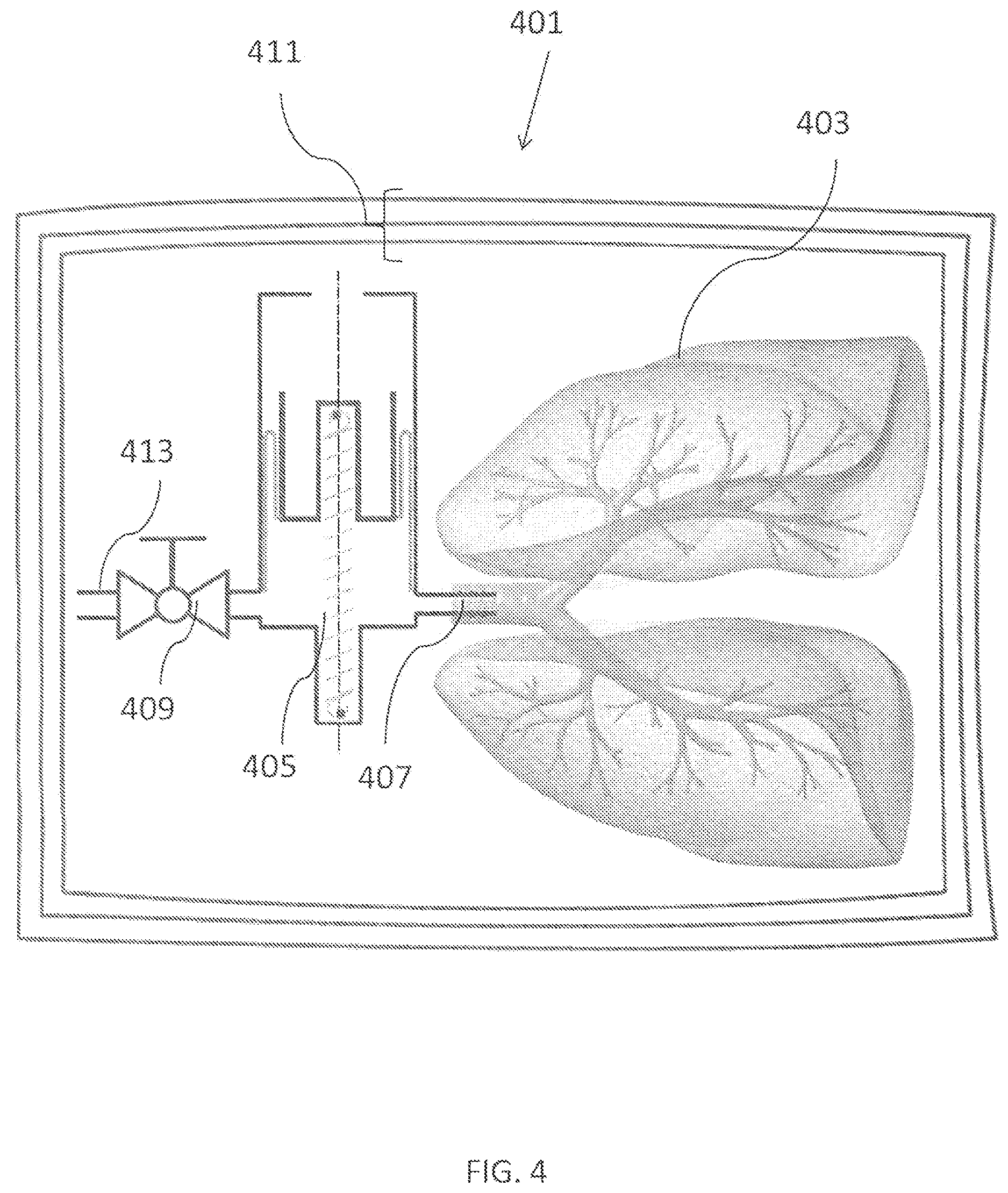 Patent US12610943 Figure 4 – Apparatus for tissue transport and preservation