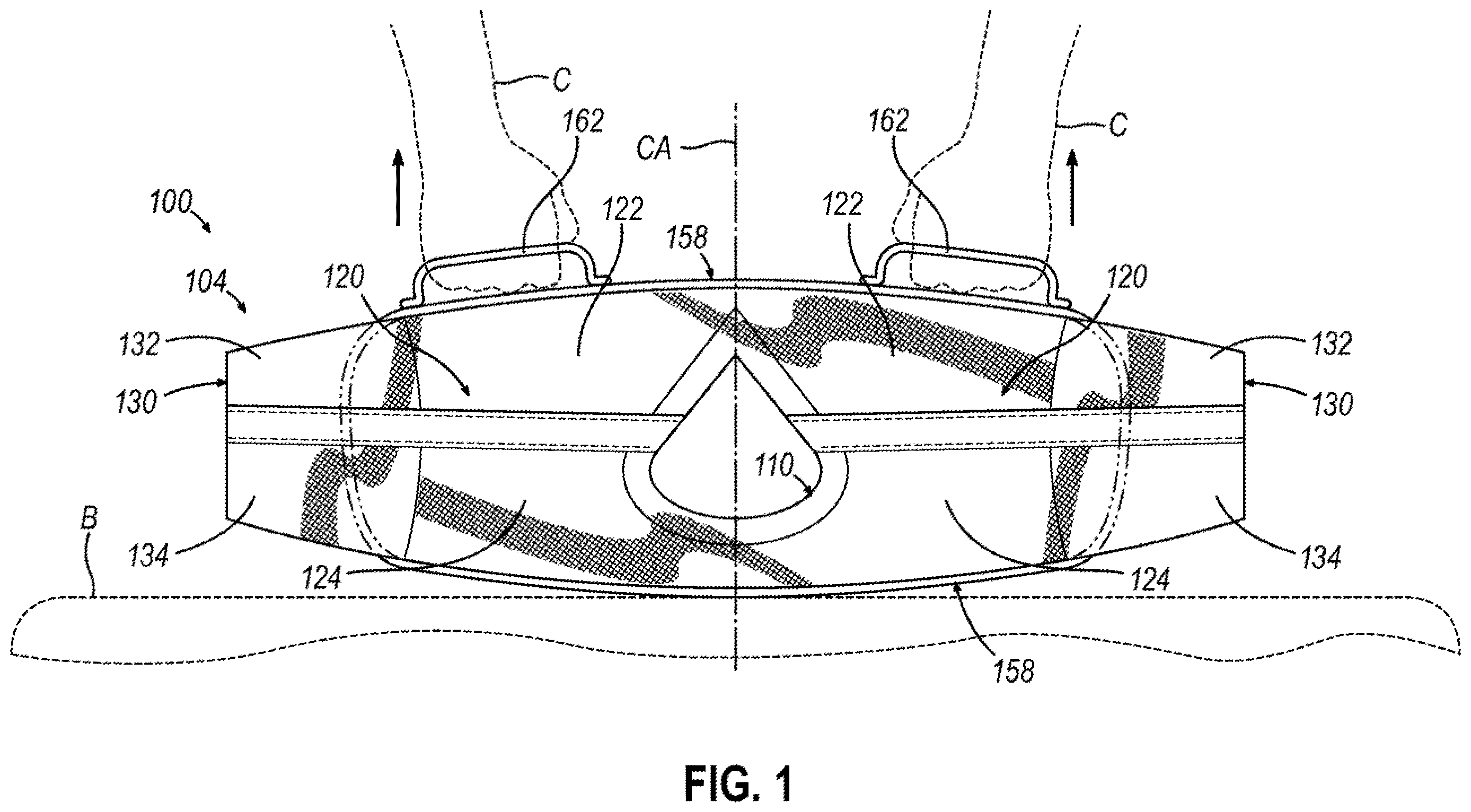Patent US12610993 Figure 1 – Patient clothing system with integrated lifting features