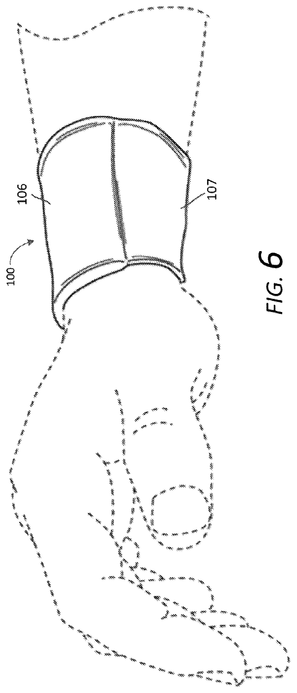 Patent US12610995 Figure 4 – Sports band article