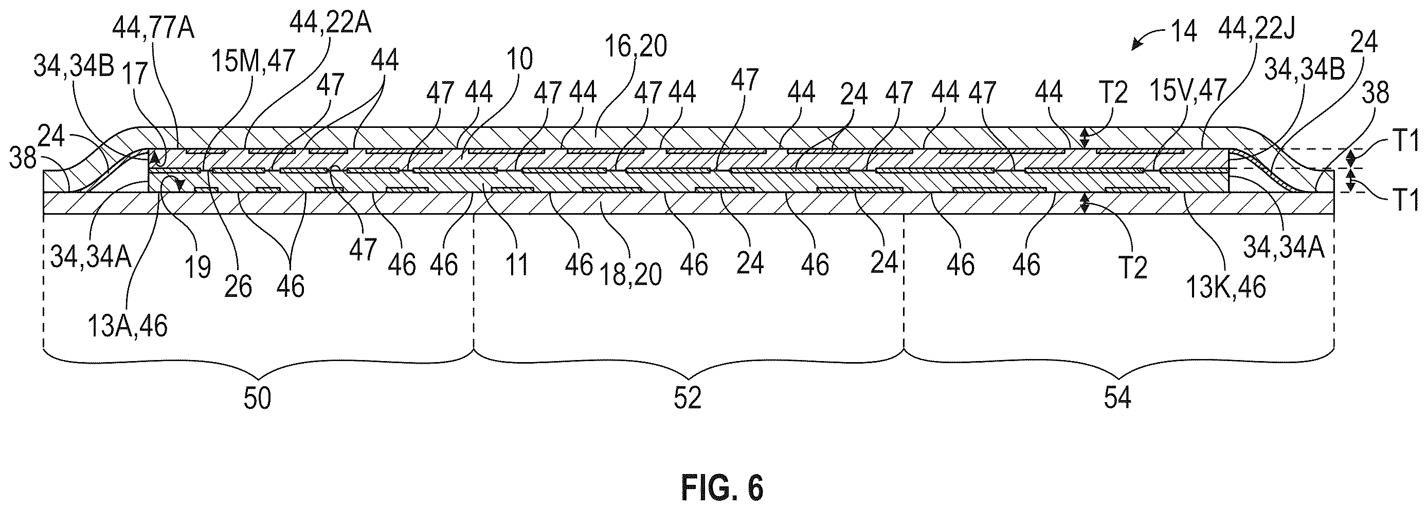 Patent US12611005 Figure 4 – Cushioning component for a wearable article