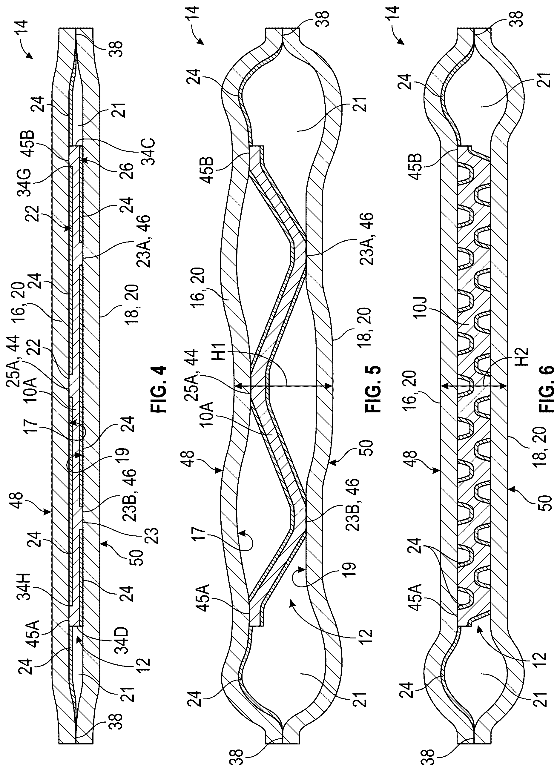 Patent US12611006 Figure 4 – Cushioning component for a wearable article and method of manufacturing same