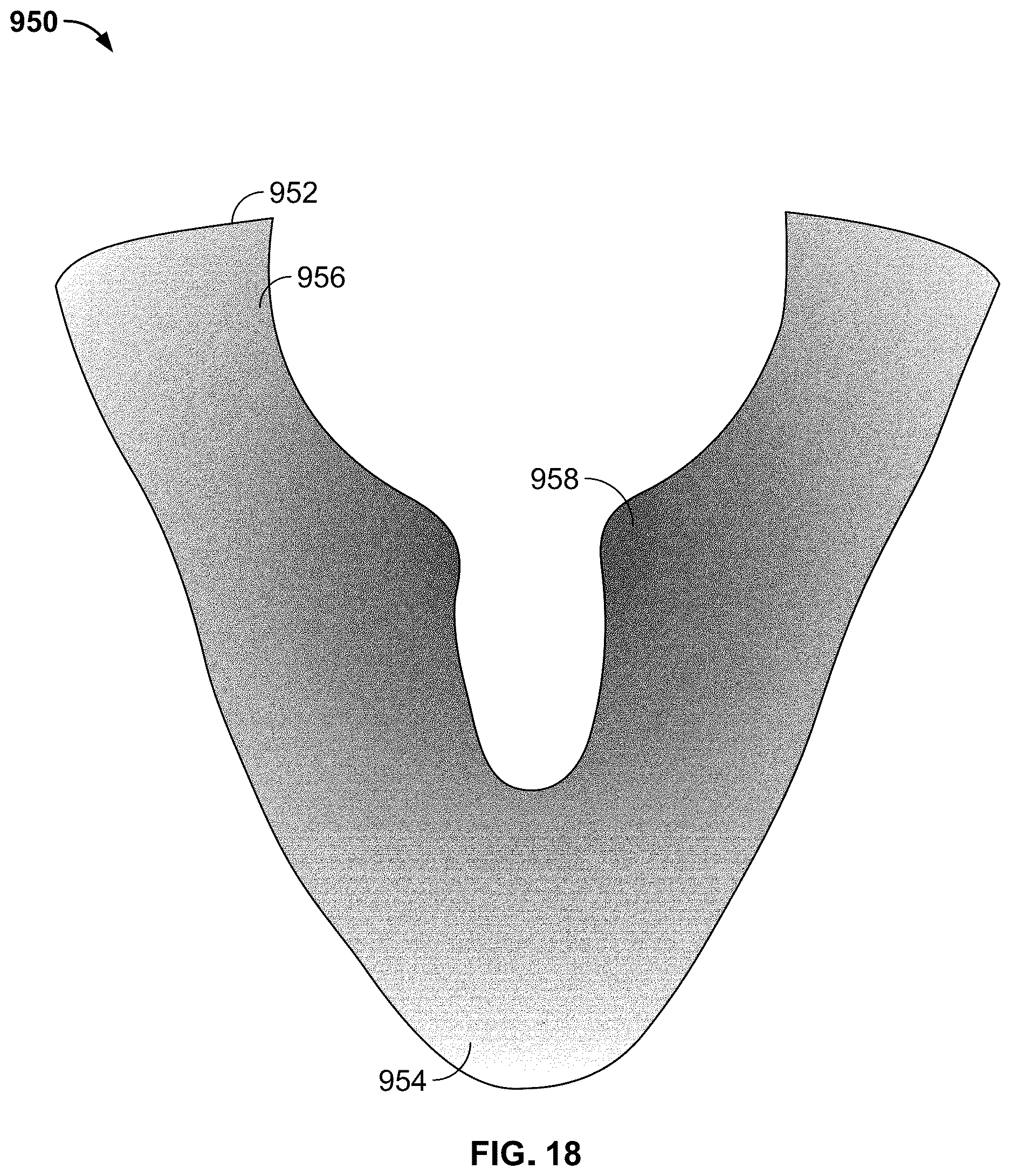 Patent US12611007 Figure 18 – Article of footwear having a degradable component