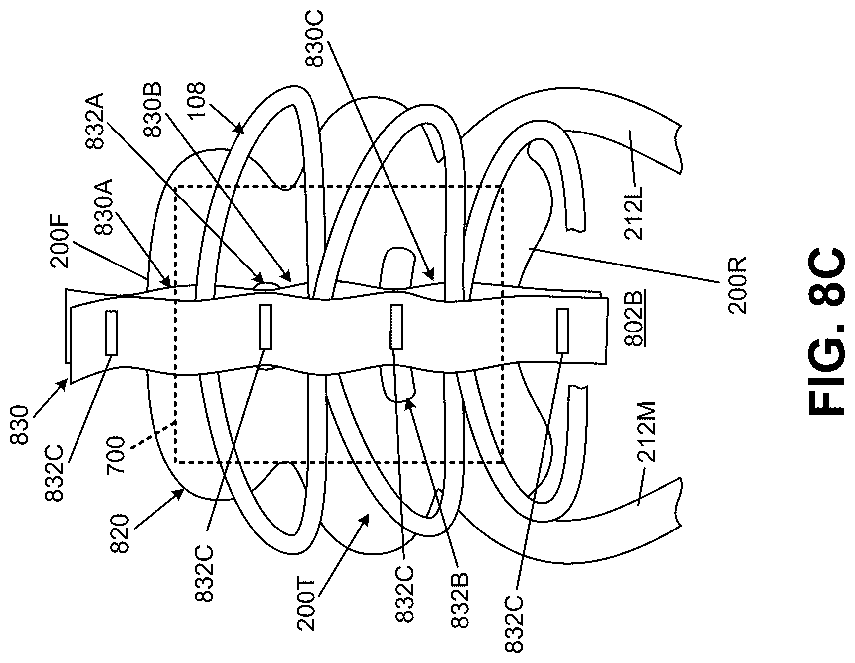 Patent US12611009 Figure 14 – Bladders, footwear uppers including bladders, and articles of footwear including bladders in the upper