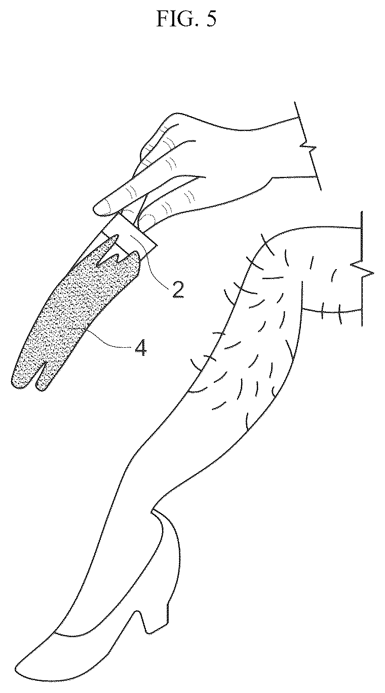 Patent US12611023 Figure 3 – Device with adhesive to aid in depilatory wax removal