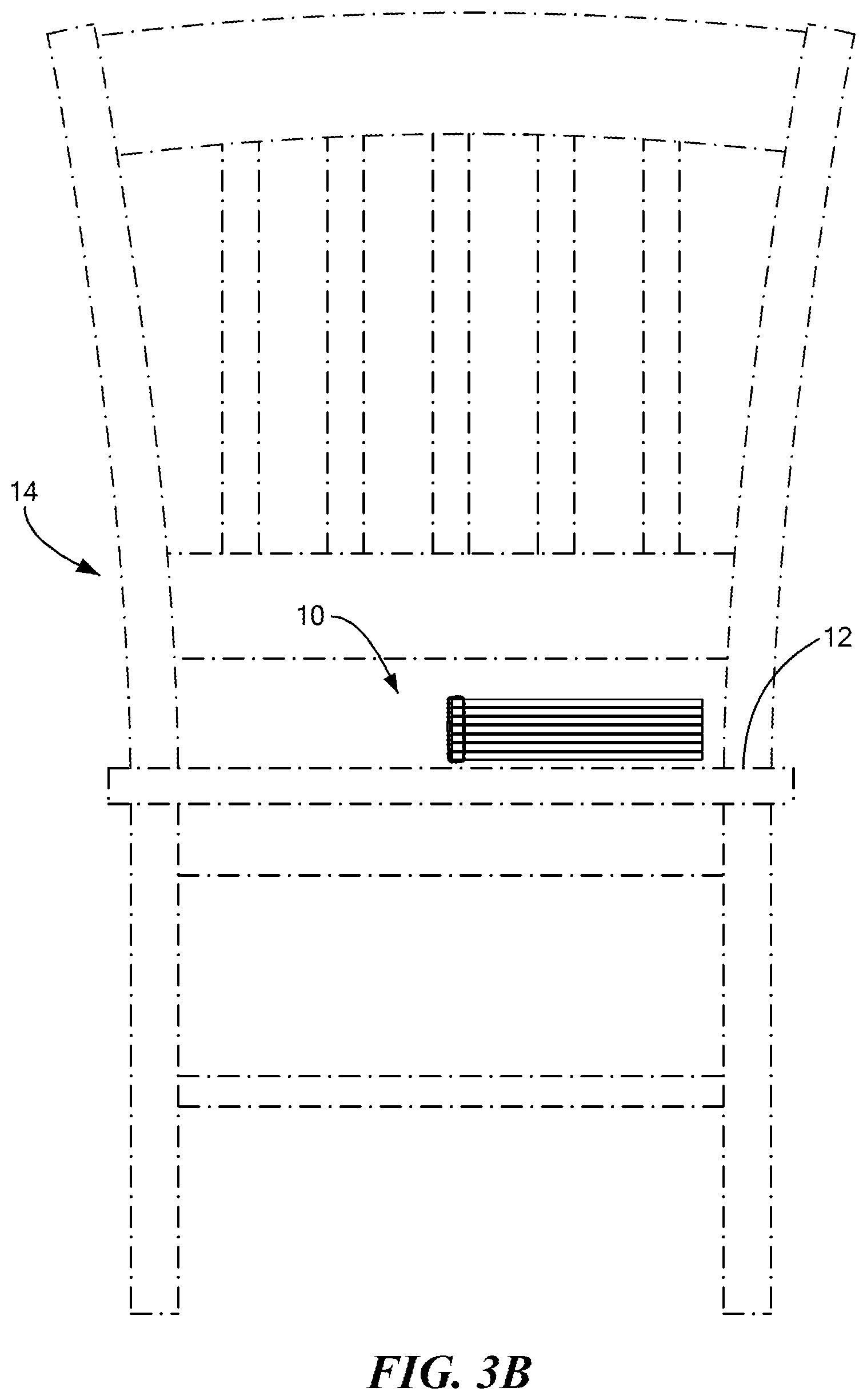 Patent US12611036 Figure 4 – Stackable lift for ischial tuberosity re-alignment of sacral/lumbar complex and method of use