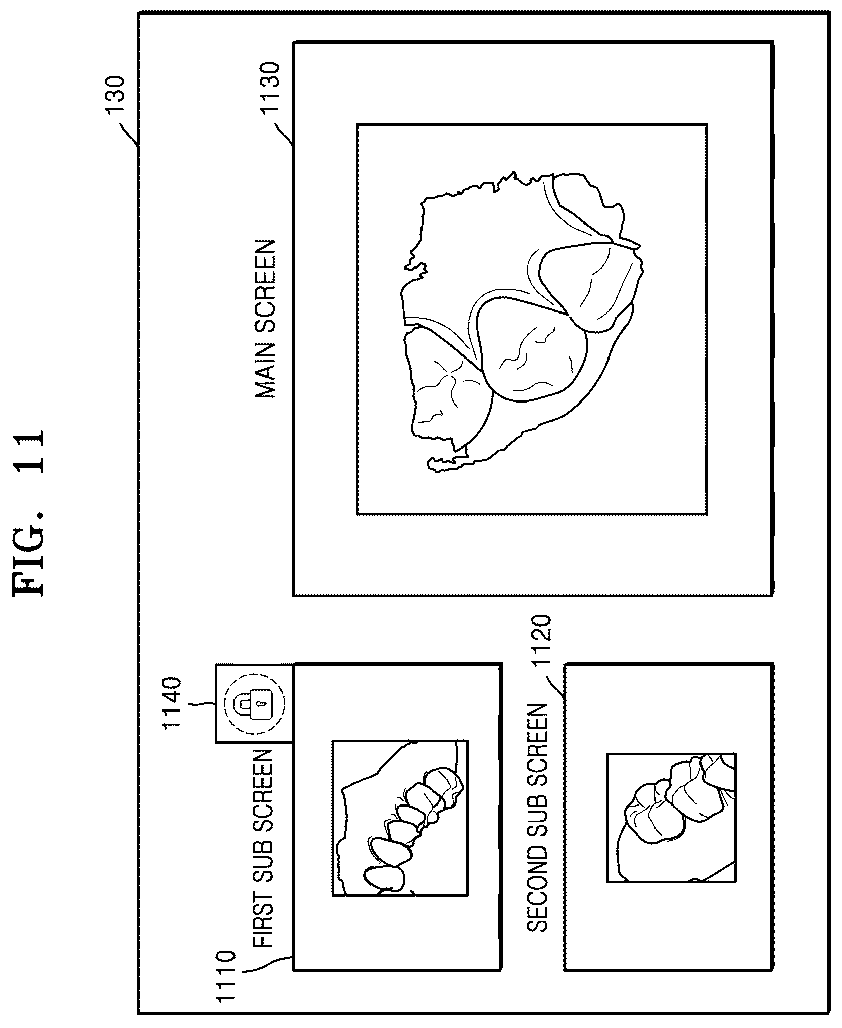 Patent US12611087 Figure 11 – Data processing device, scanner, and method for operating same