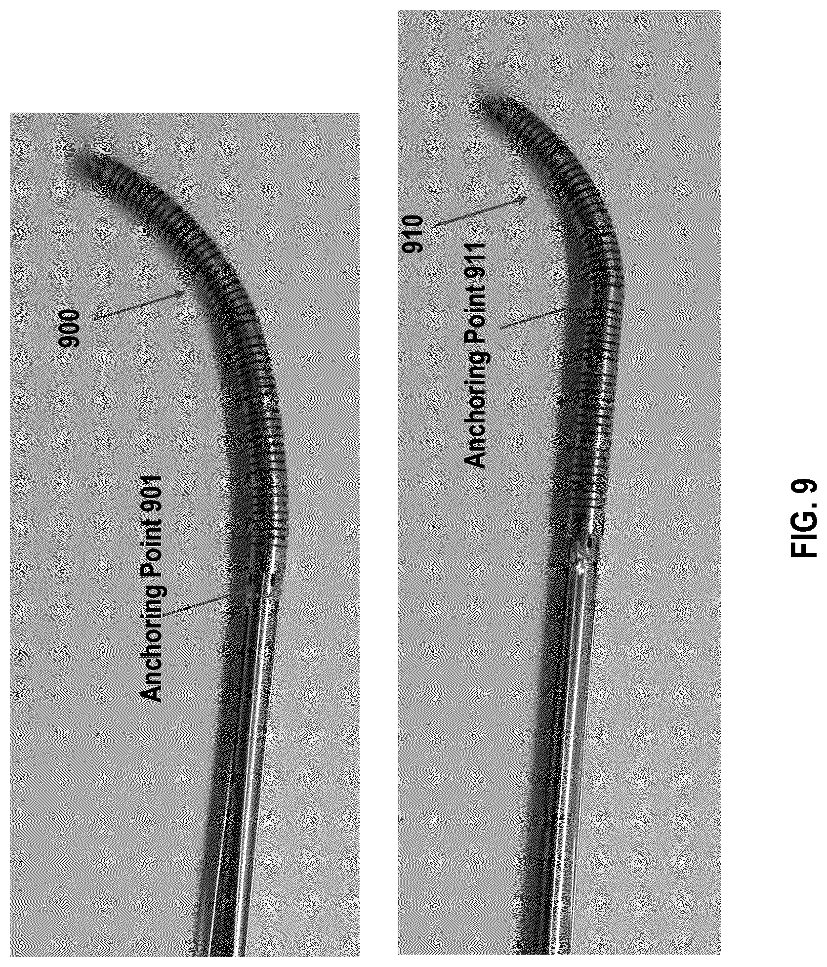 Patent US12611092 Figure 12 – Systems and methods for configurable endoscope bending section