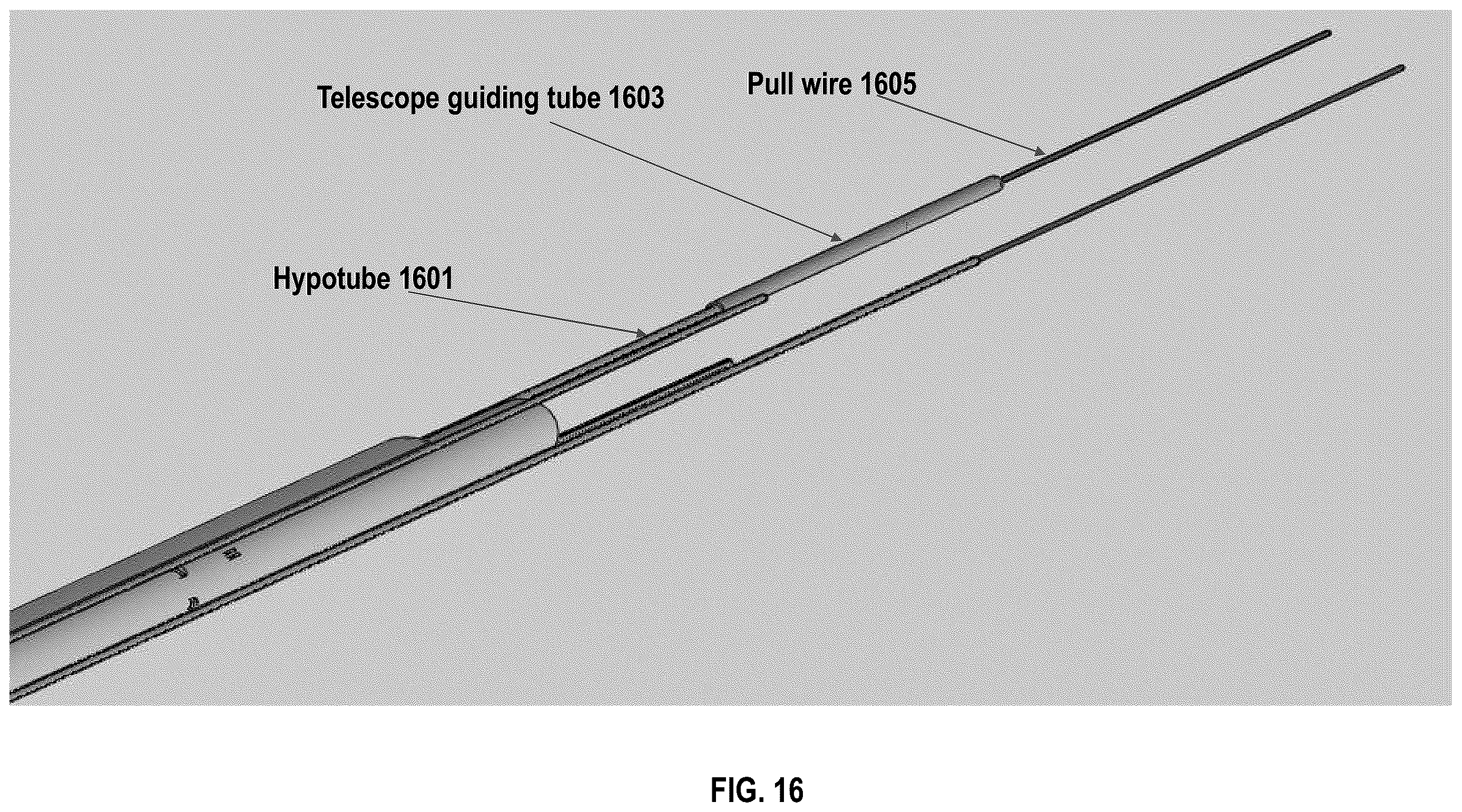 Patent US12611092 Figure 20 – Systems and methods for configurable endoscope bending section