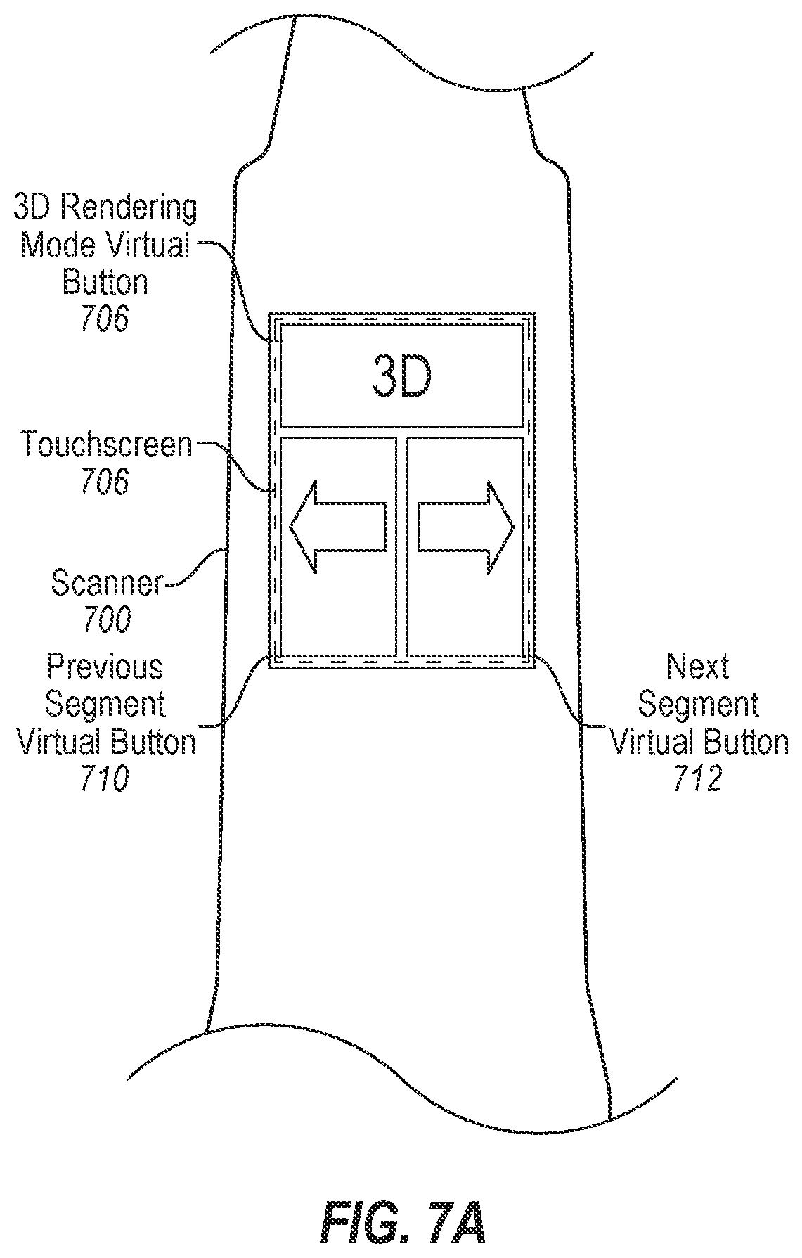 Patent US12611096 Figure 9 – Minimalistic intraoral scanning system