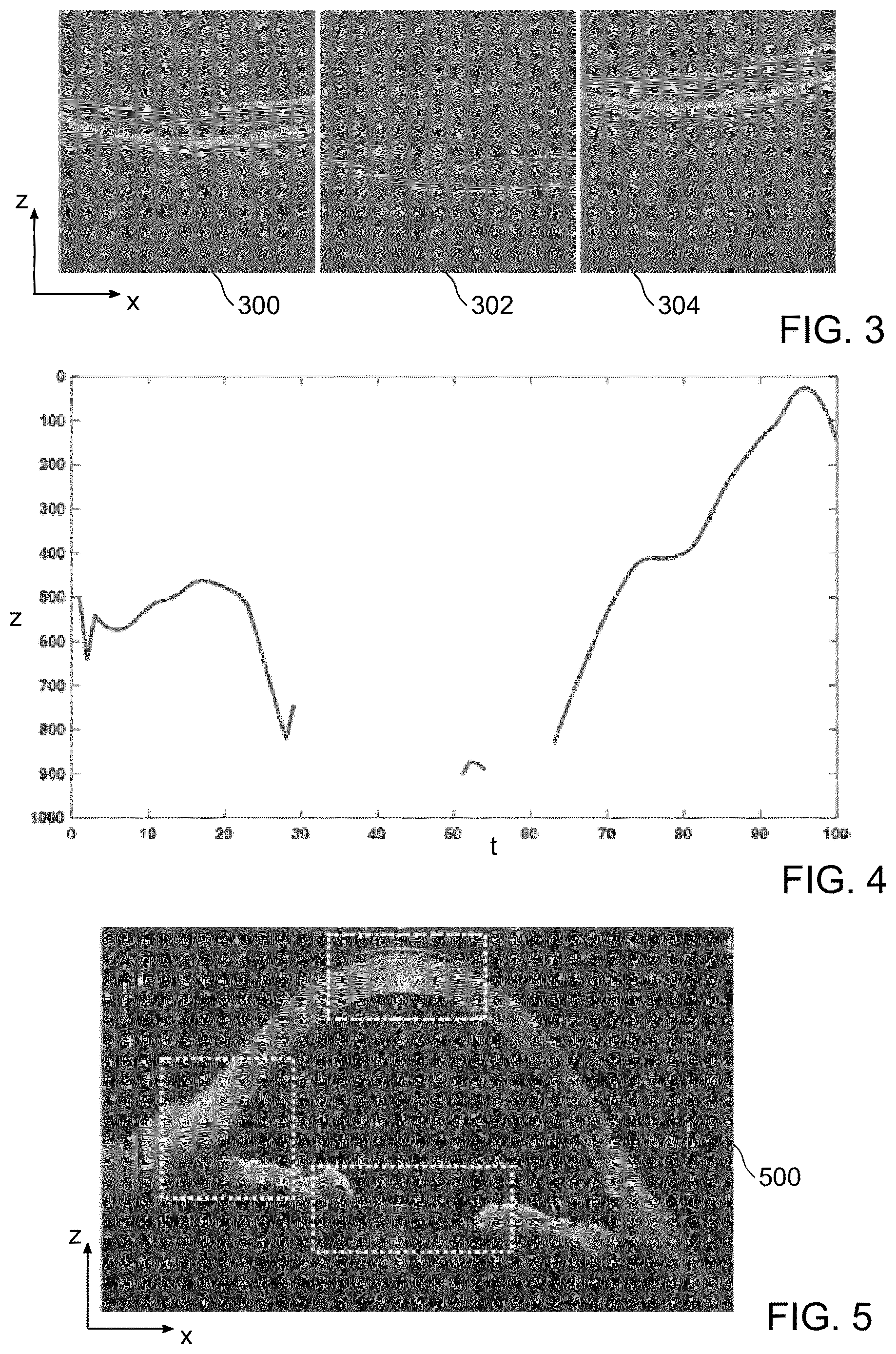 Patent US12611098 Figure 3 – Control system for OCT imaging, OCT imaging system and method for OCT imaging