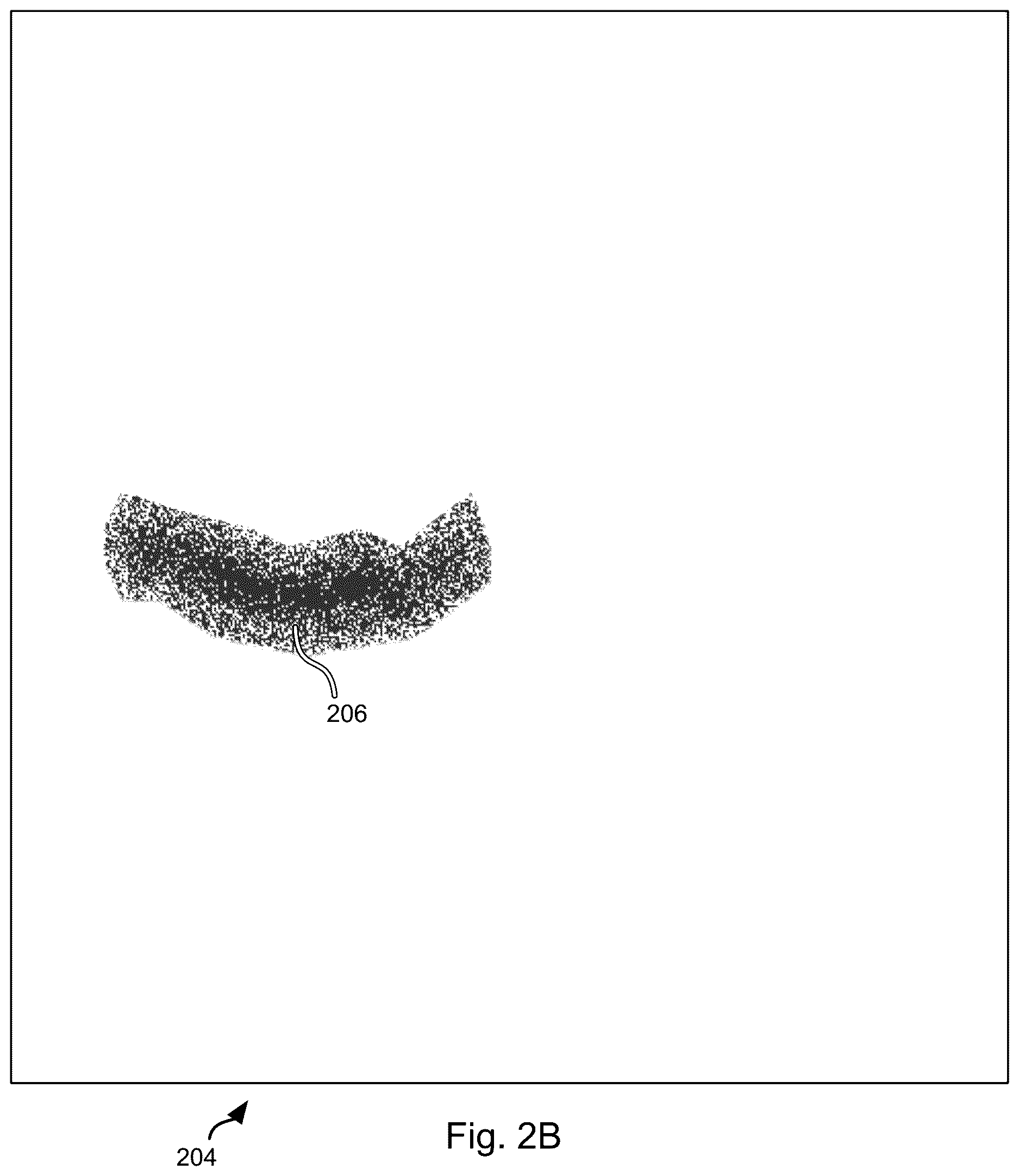 Patent US12611099 Figure 3 – Psychophysical evaluation of the effect of vitreous floaters