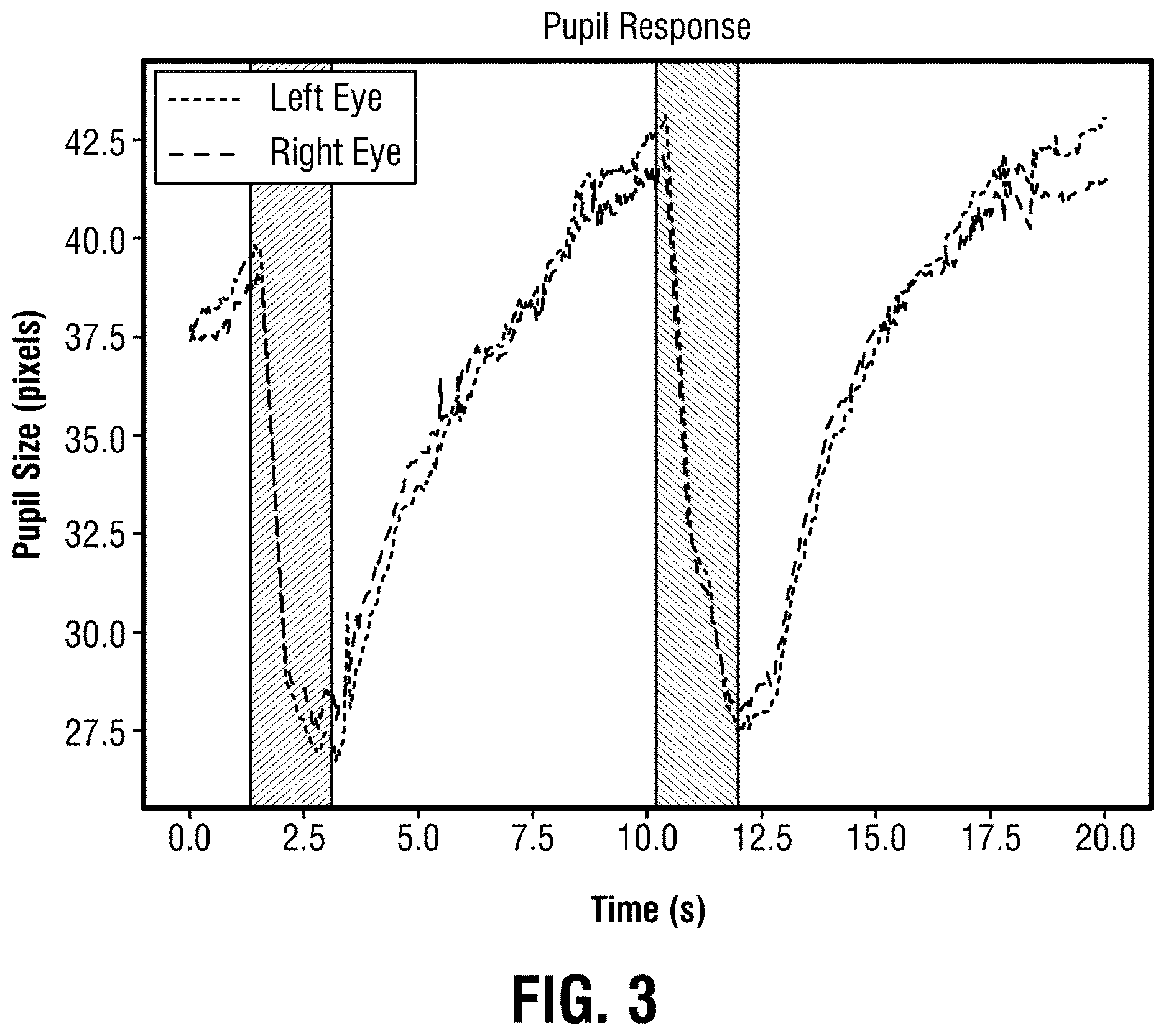Patent US12611100 Figure 3 – Afferent pupil defect testing in a VR headset