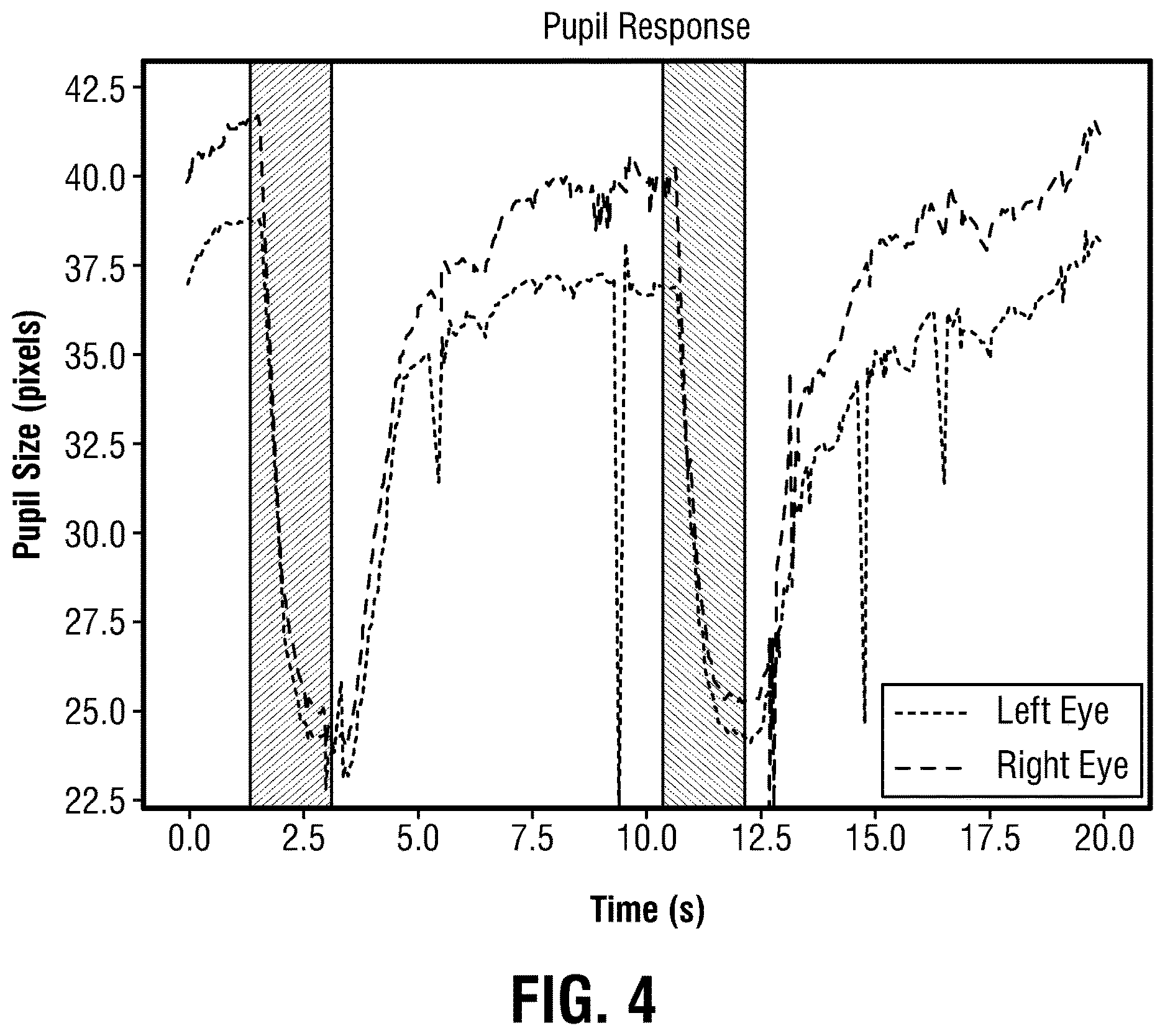 Patent US12611100 Figure 4 – Afferent pupil defect testing in a VR headset