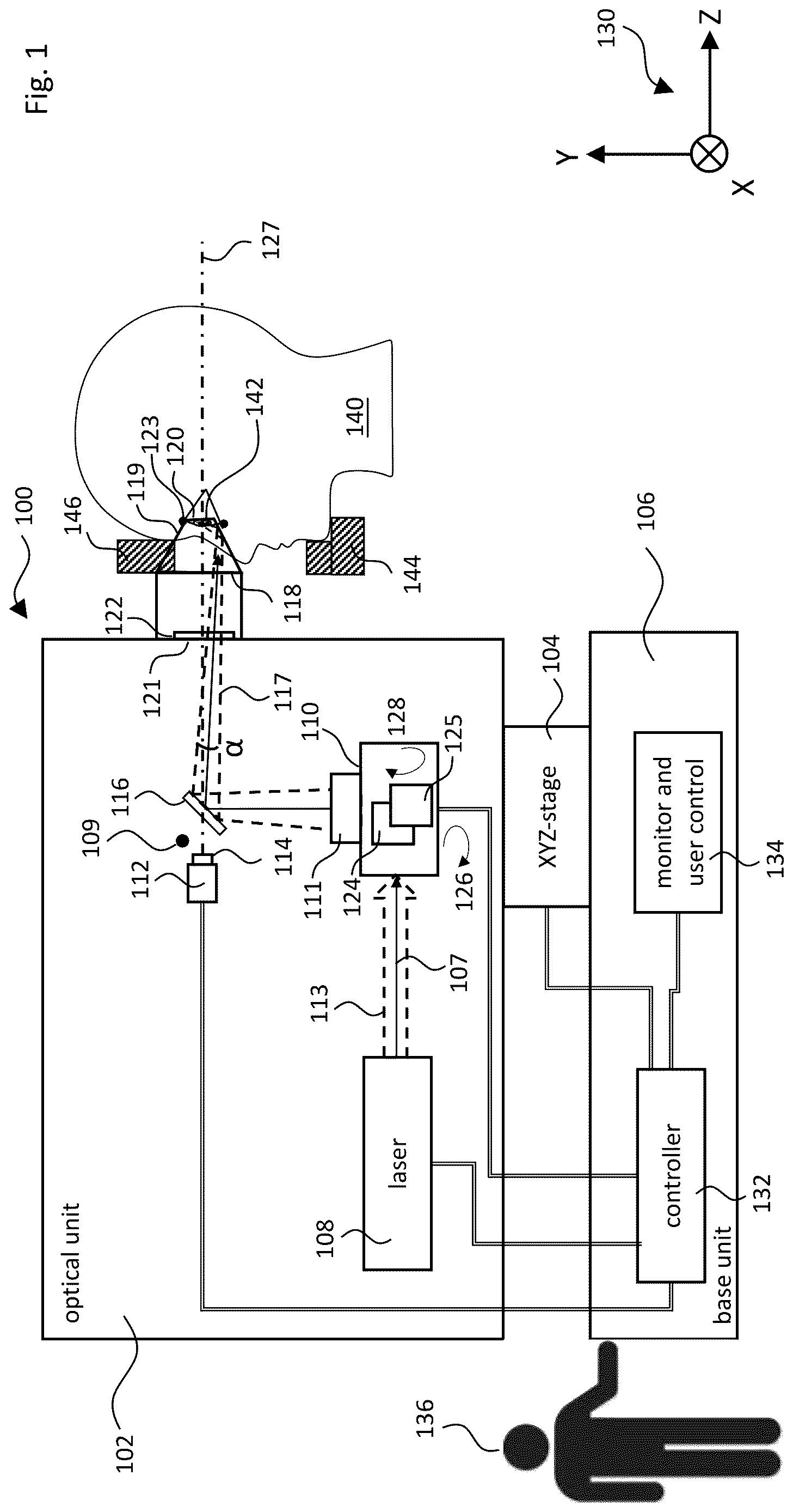 Patent US12611101 — Gonioscopic laser surgery — Figure 1