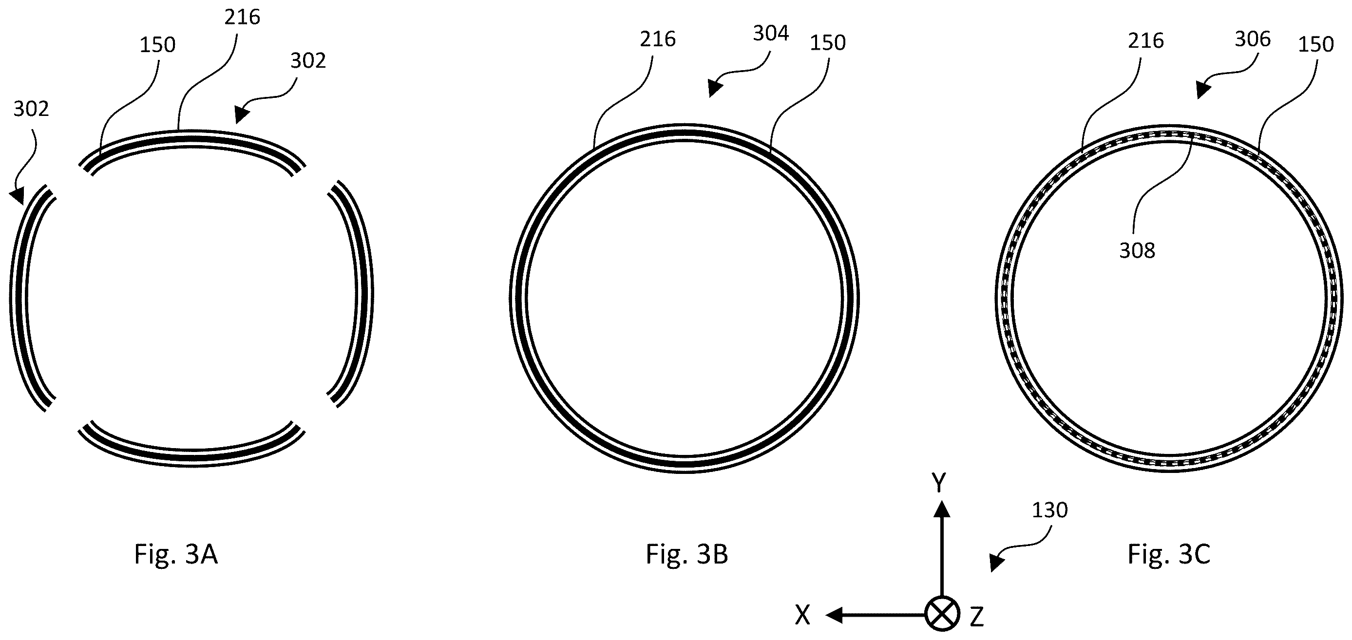 Patent US12611101 Figure 3 – Gonioscopic laser surgery