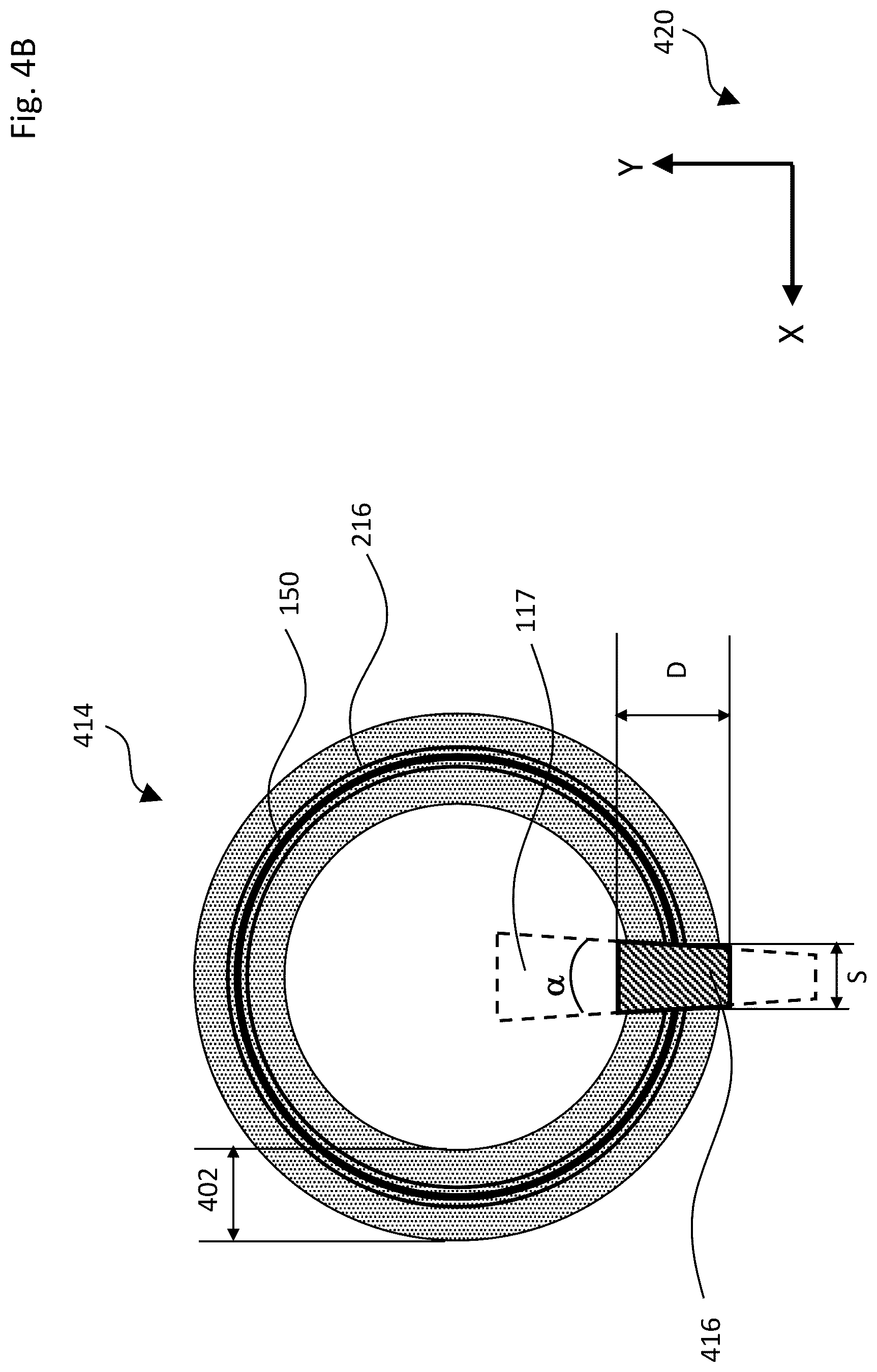 Patent US12611101 Figure 5 – Gonioscopic laser surgery
