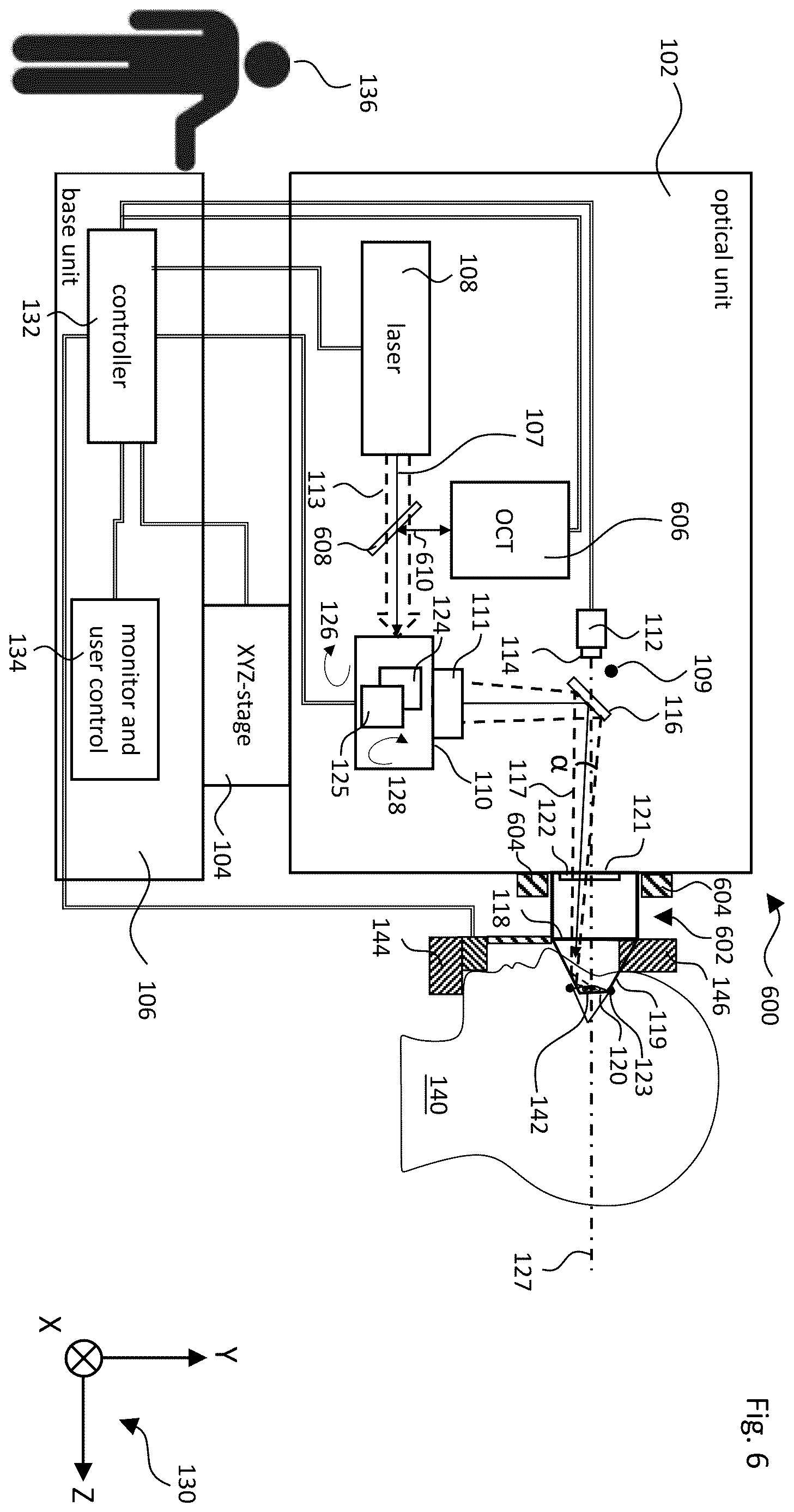 Patent US12611101 Figure 7 – Gonioscopic laser surgery