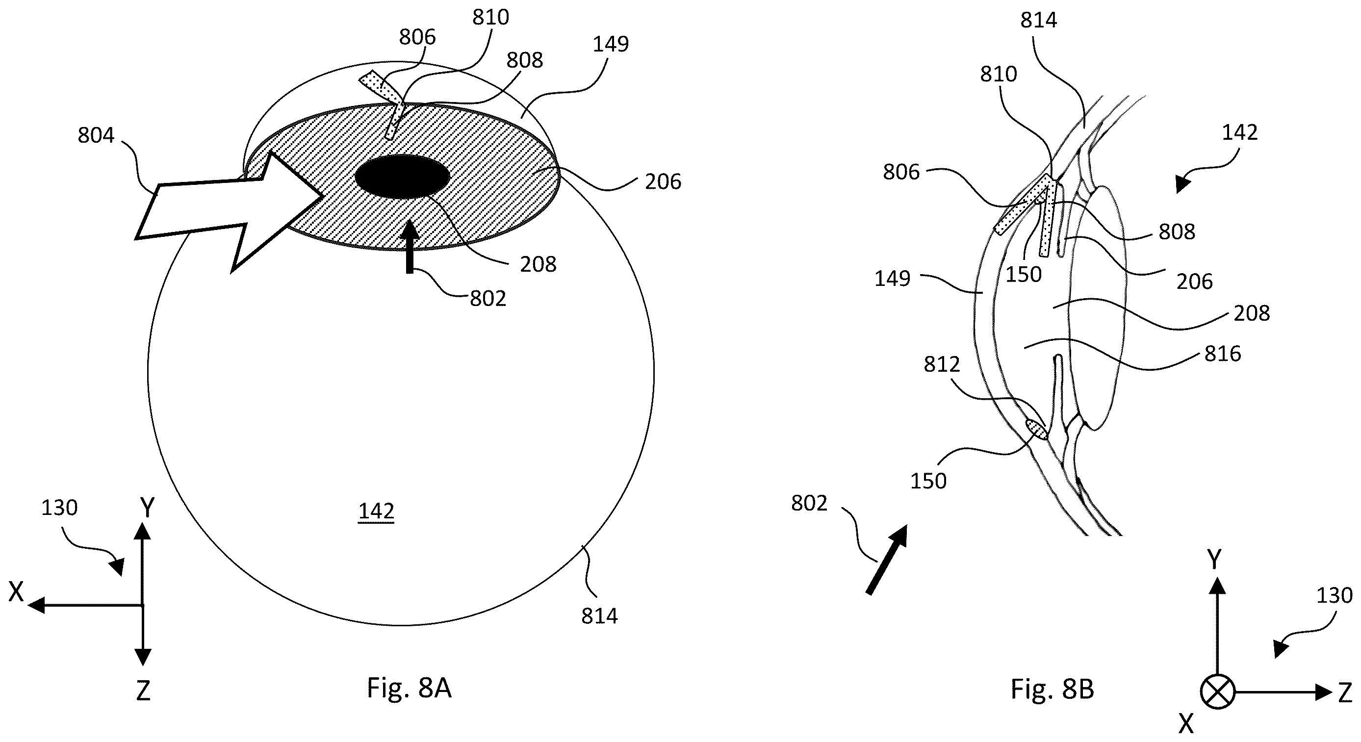 Patent US12611101 Figure 9 – Gonioscopic laser surgery