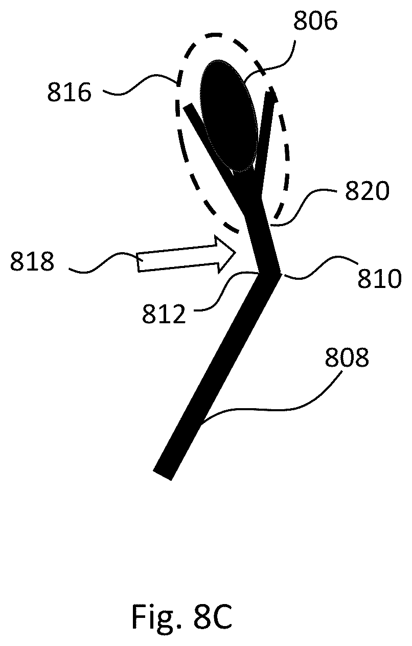 Patent US12611101 Figure 10 – Gonioscopic laser surgery