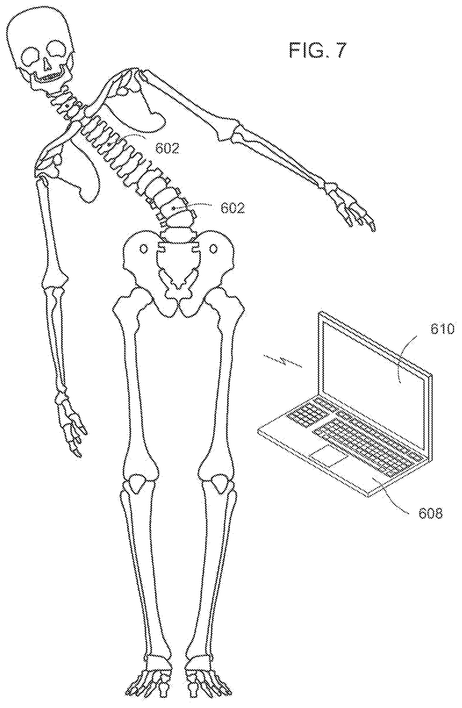 Patent US12611104 Figure 4 – Method for detecting body parameters