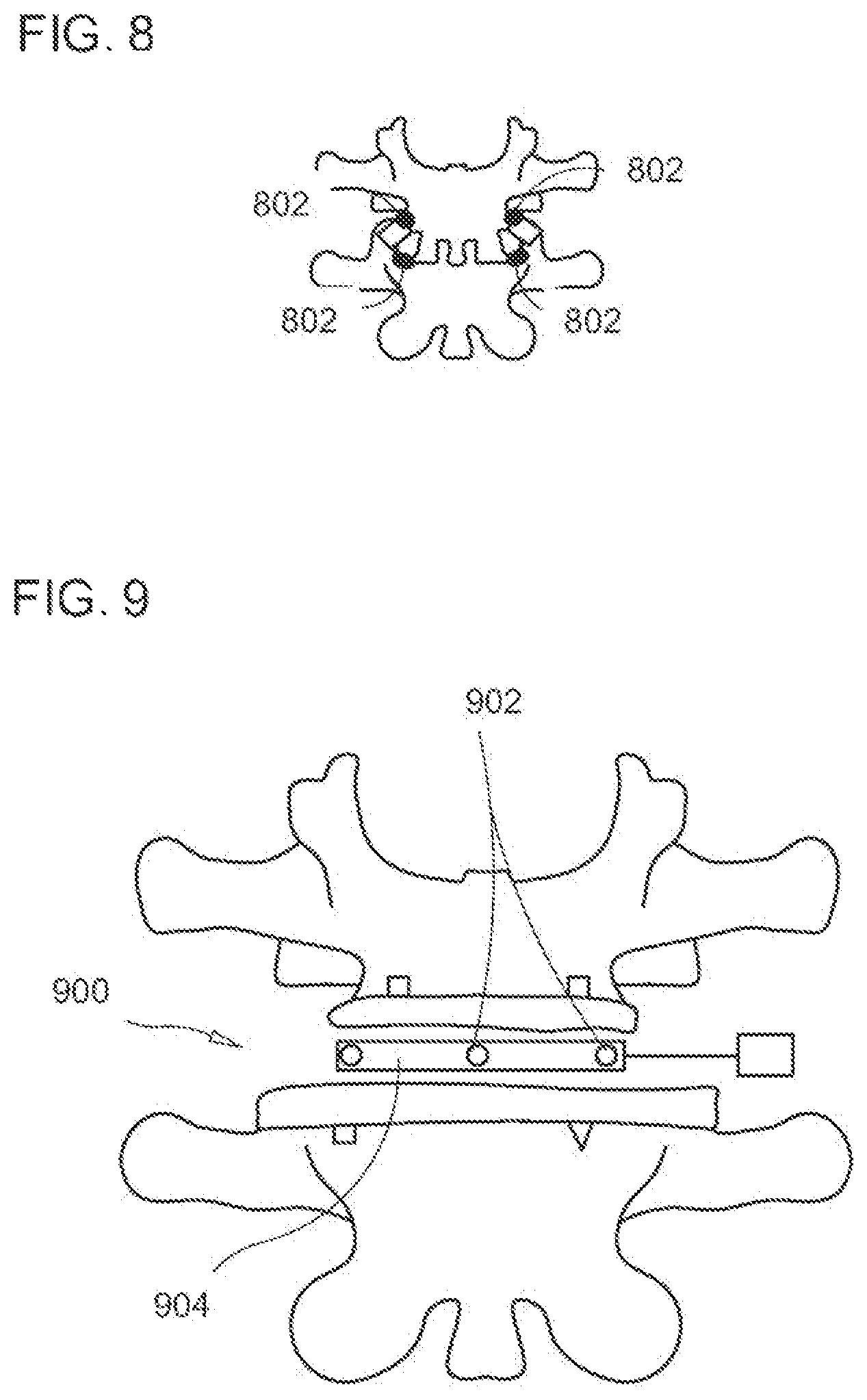 Patent US12611104 Figure 5 – Method for detecting body parameters