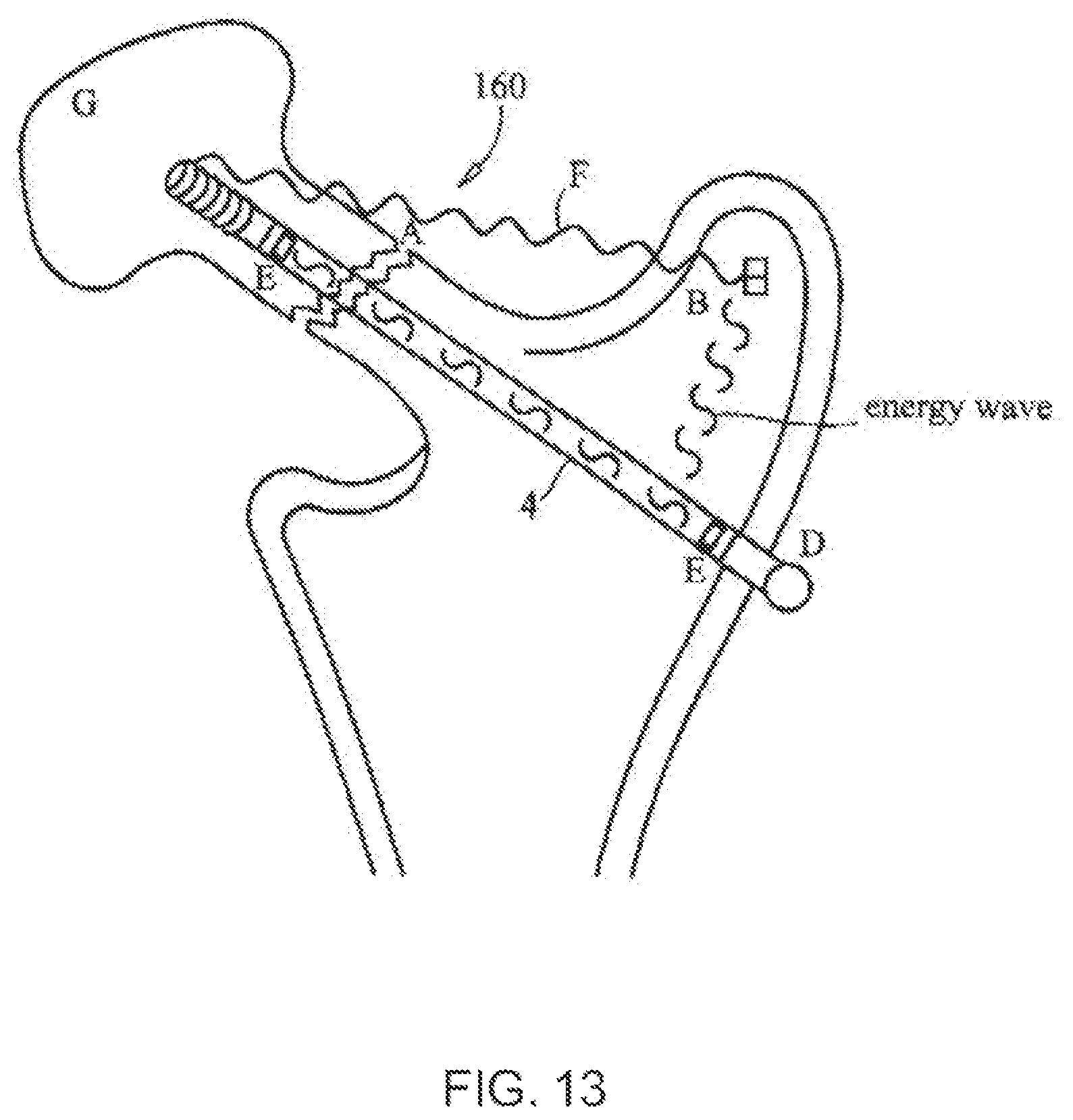 Patent US12611104 Figure 7 – Method for detecting body parameters
