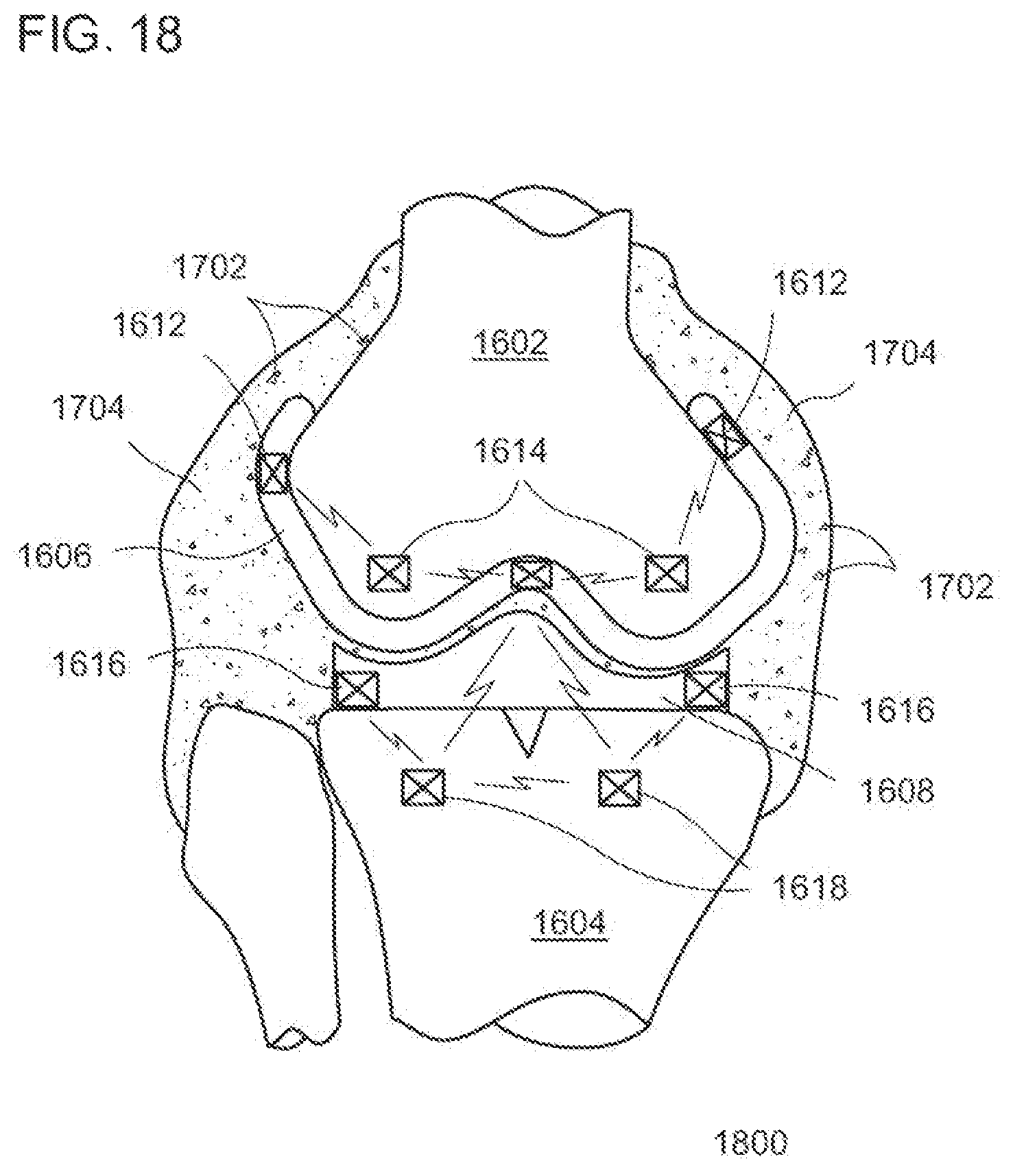 Patent US12611104 Figure 10 – Method for detecting body parameters
