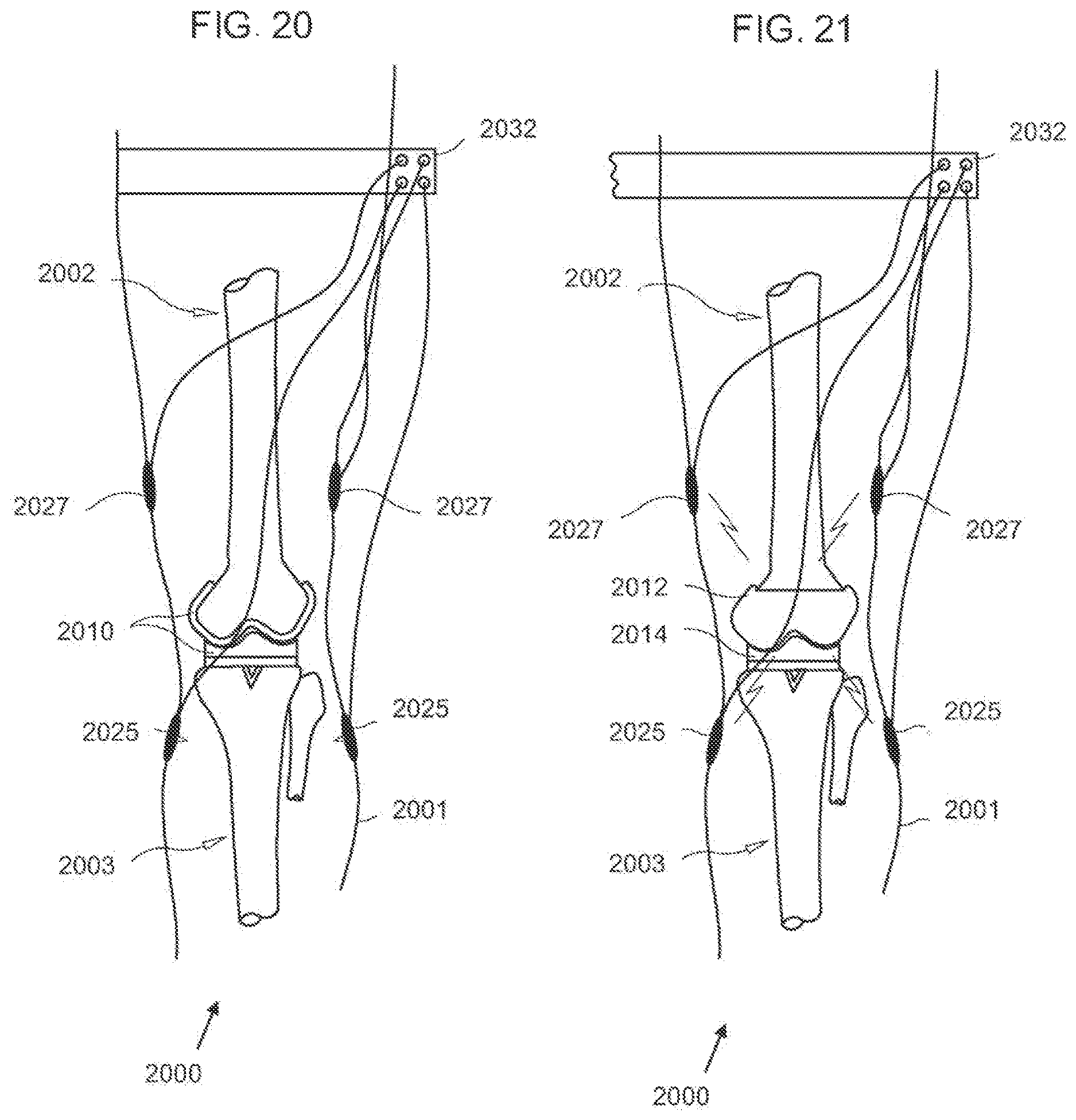 Patent US12611104 Figure 12 – Method for detecting body parameters