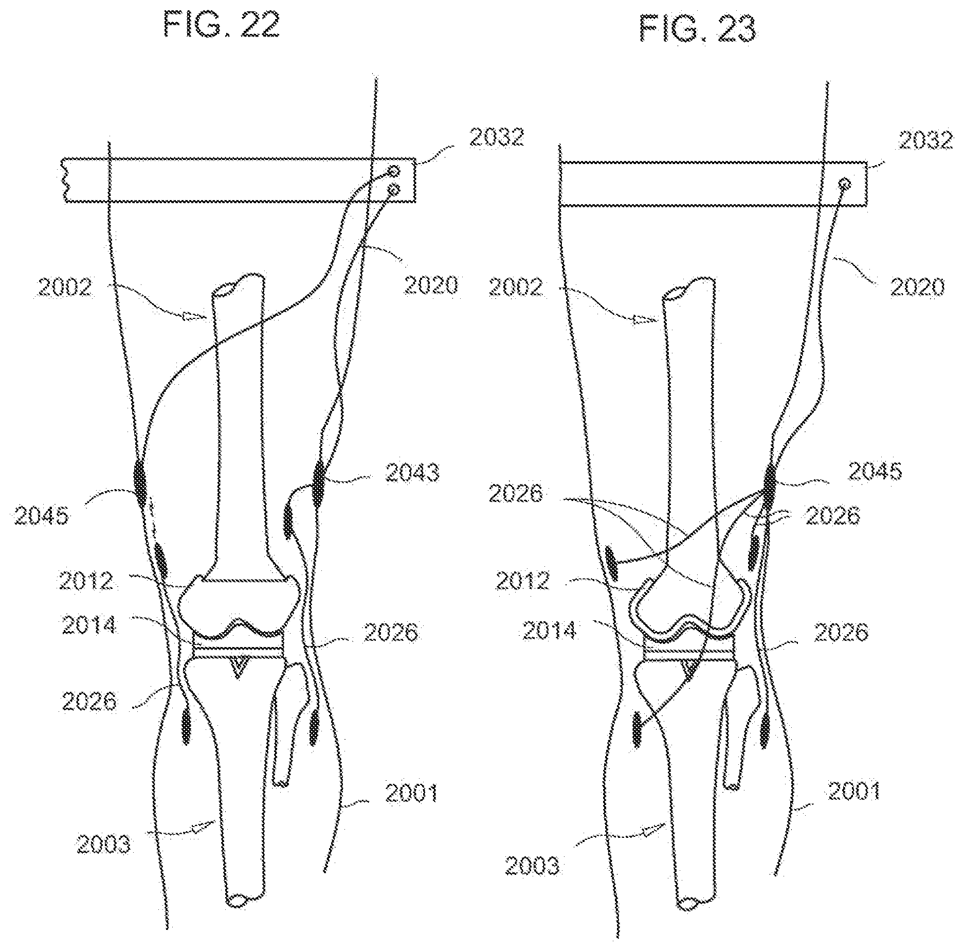 Patent US12611104 Figure 13 – Method for detecting body parameters