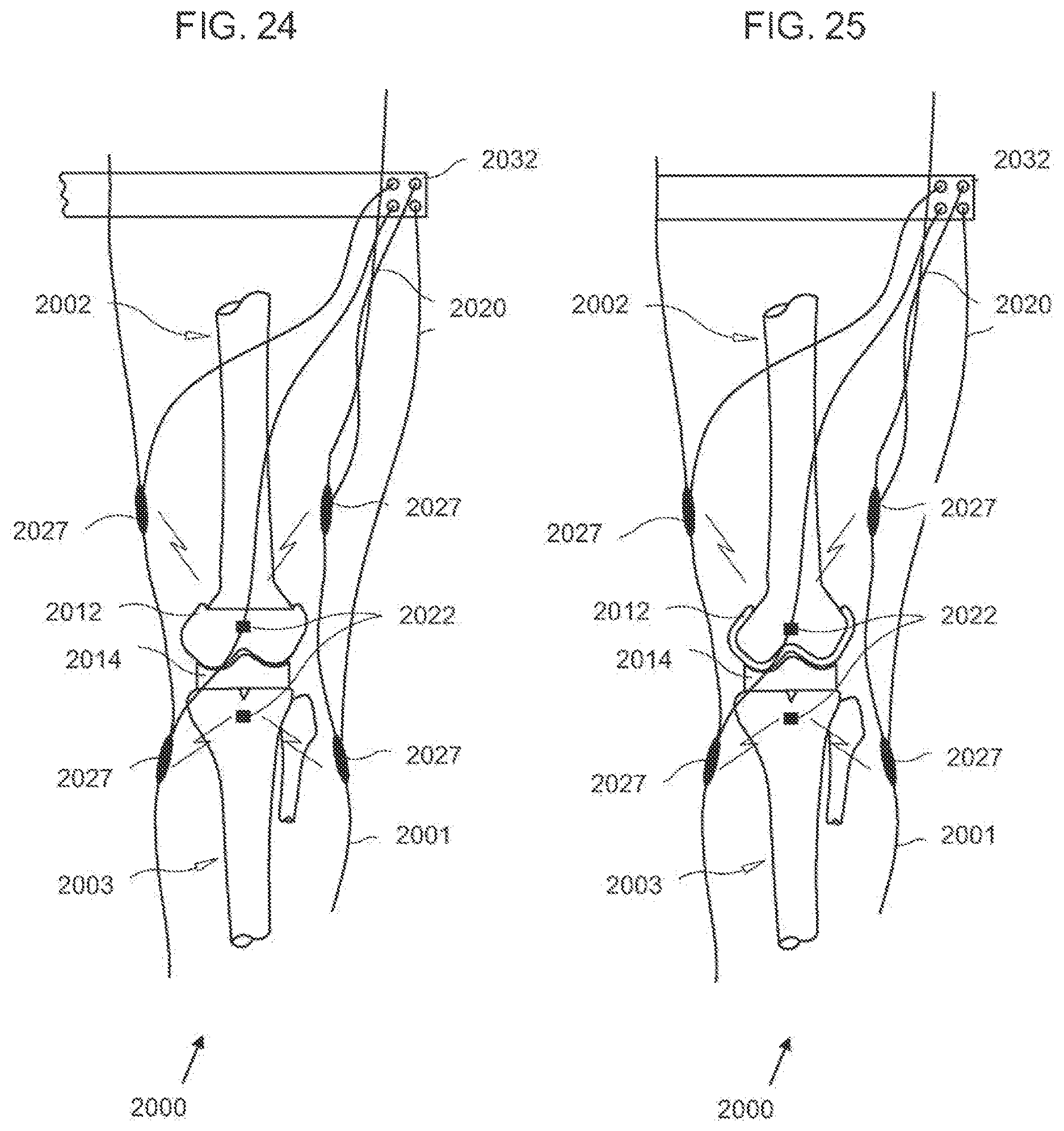 Patent US12611104 Figure 14 – Method for detecting body parameters