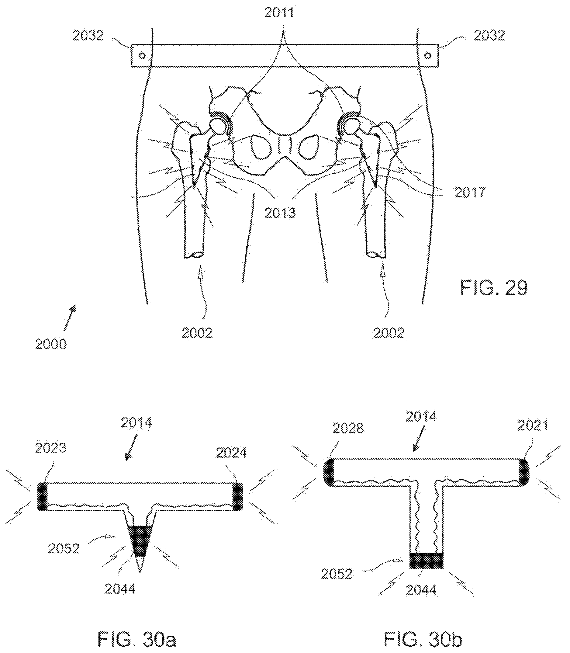 Patent US12611104 Figure 17 – Method for detecting body parameters