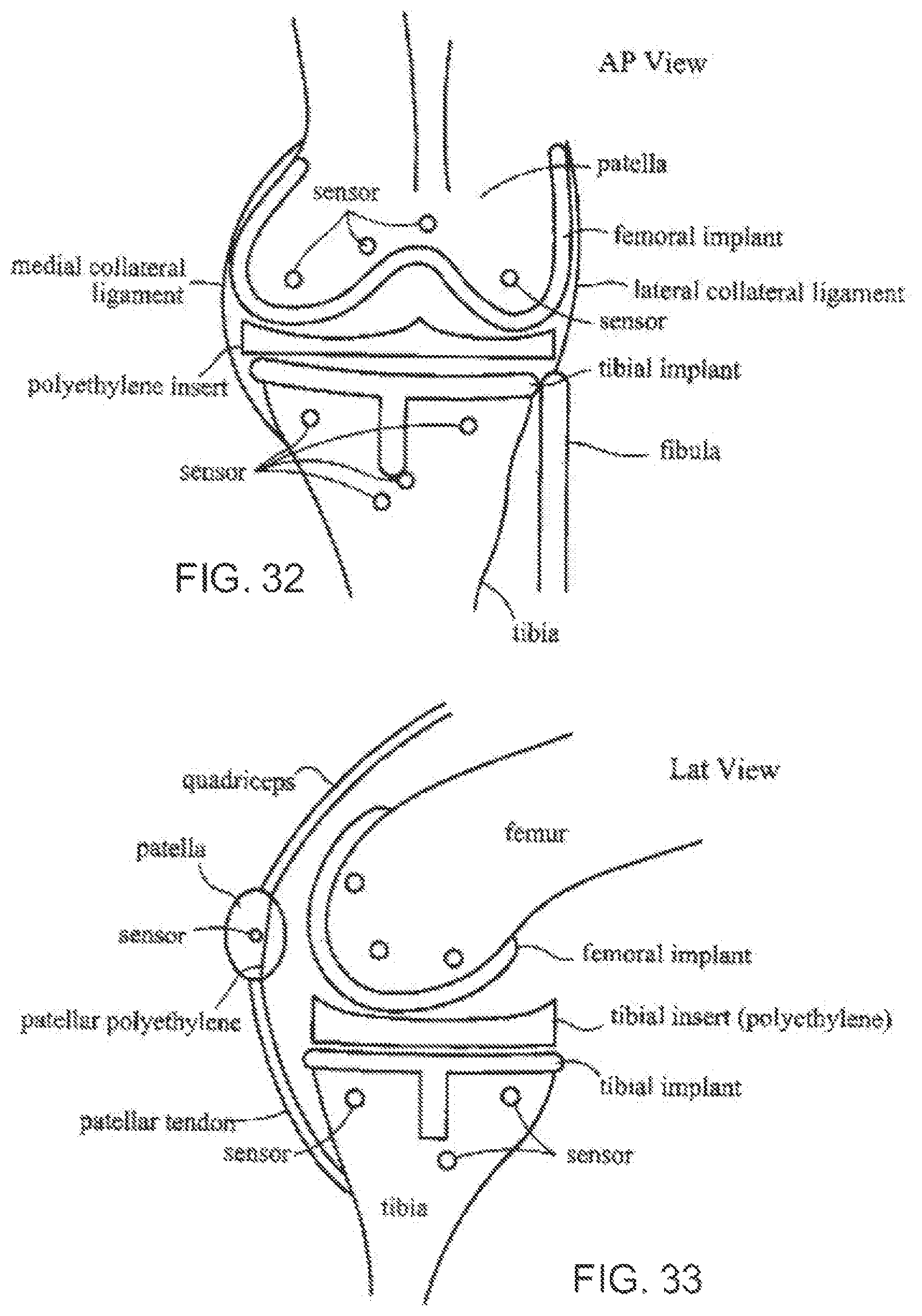 Patent US12611104 Figure 19 – Method for detecting body parameters