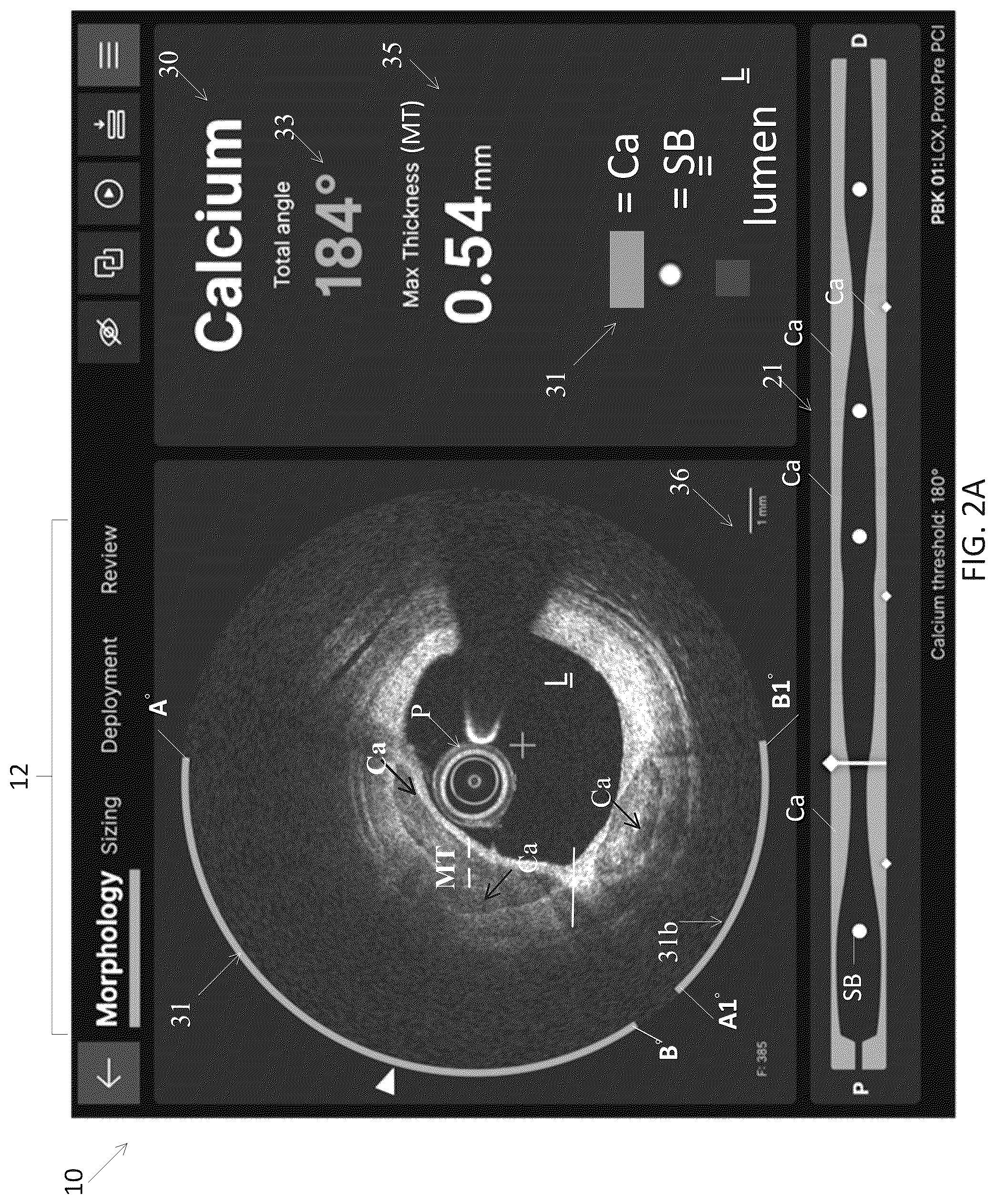 Patent US12611105 Figure 2 – Arterial imaging and assessment systems and methods and related user interface based-workflows